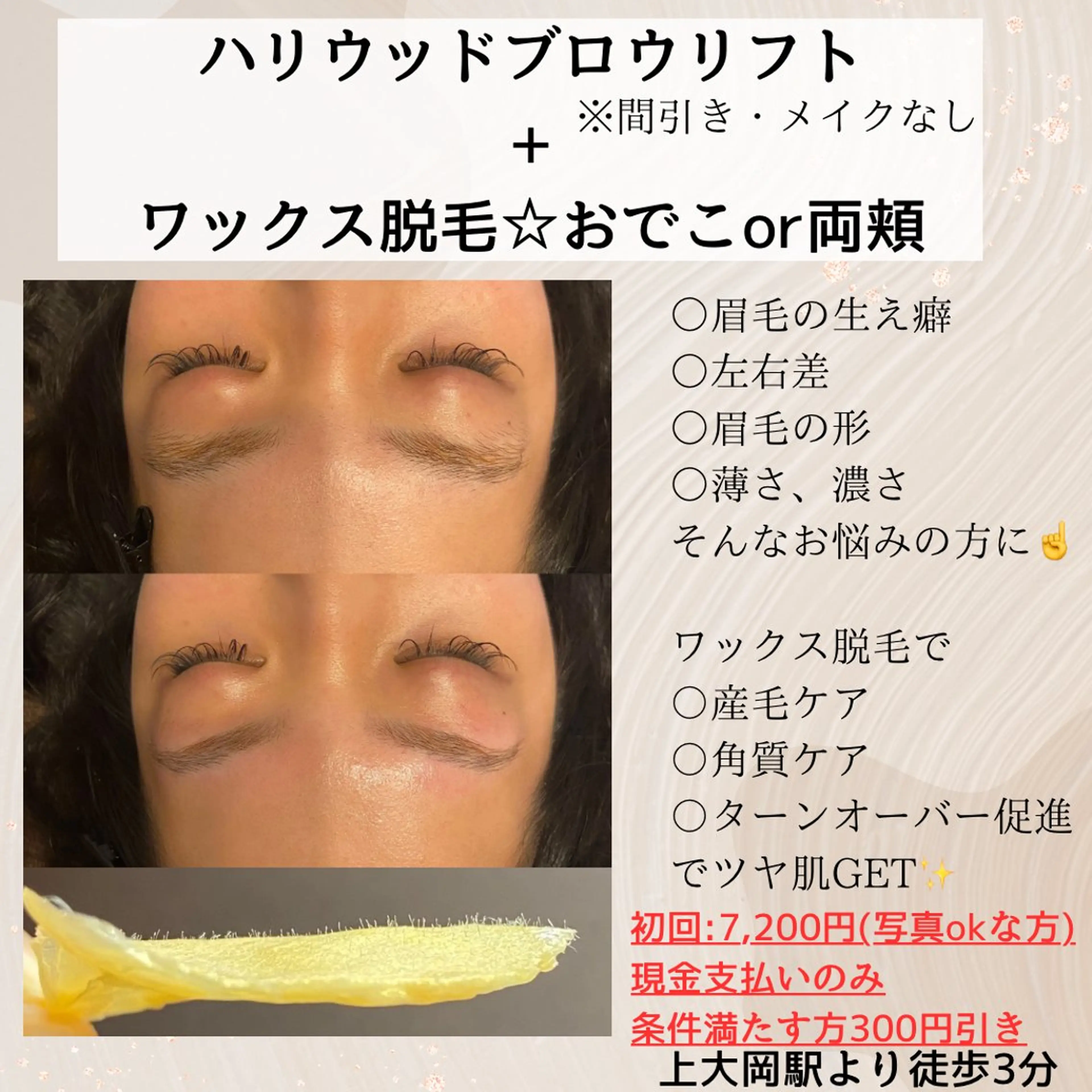 HBL眉癖改善施術+フェイシャルワックス脱毛(おでこor両頬)カウンセリング→眉癖改善→ワックス脱毛→毛抜きの写真