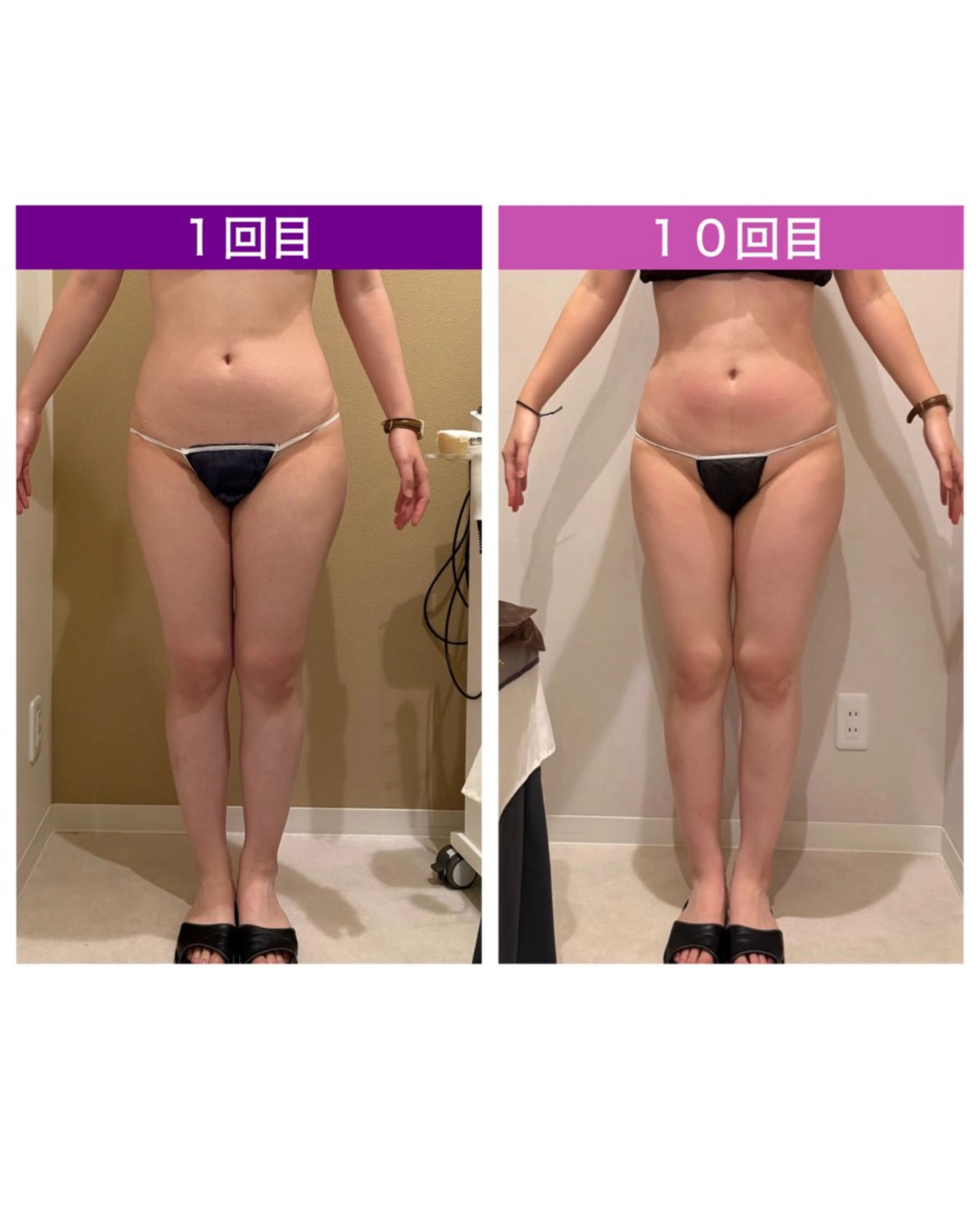 ☆痩身/小顔☆ 結果出します☆のエステ・リラクイメージ
