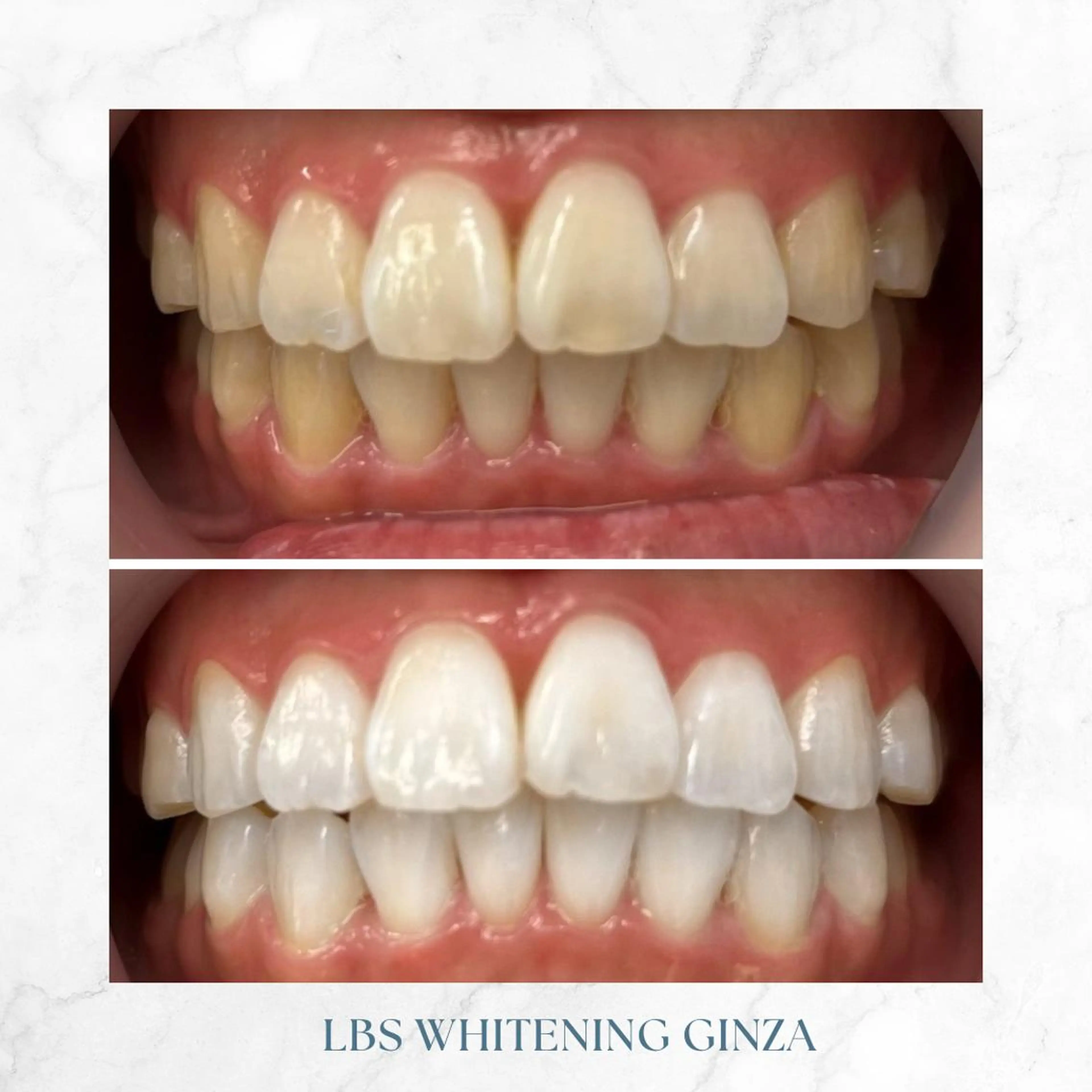 メンズ LBSホワイトニング 銀座店💎公式のその他イメージ