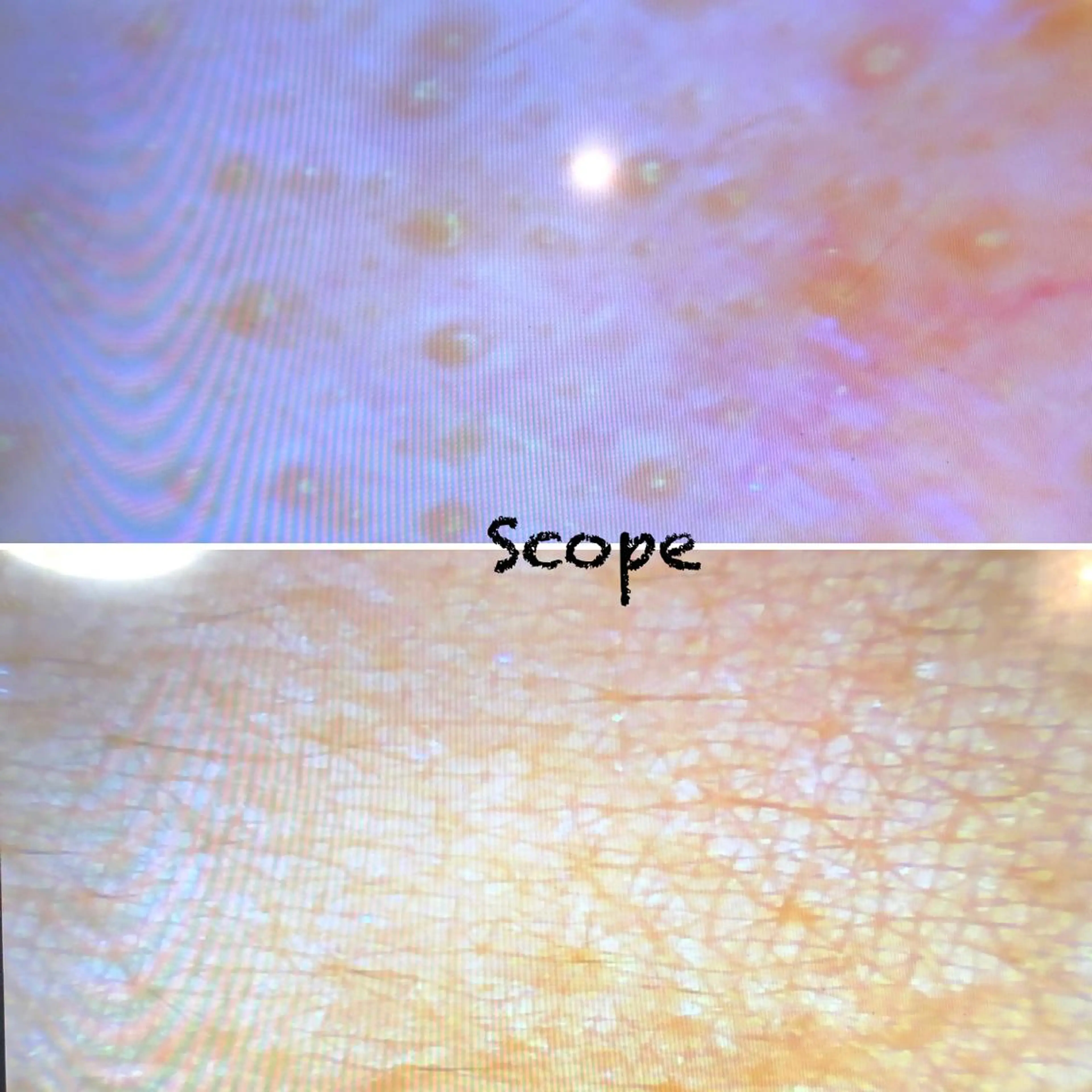 スキンスコープで肌チェック(キメ、潤い、毛穴、シミ等)の写真