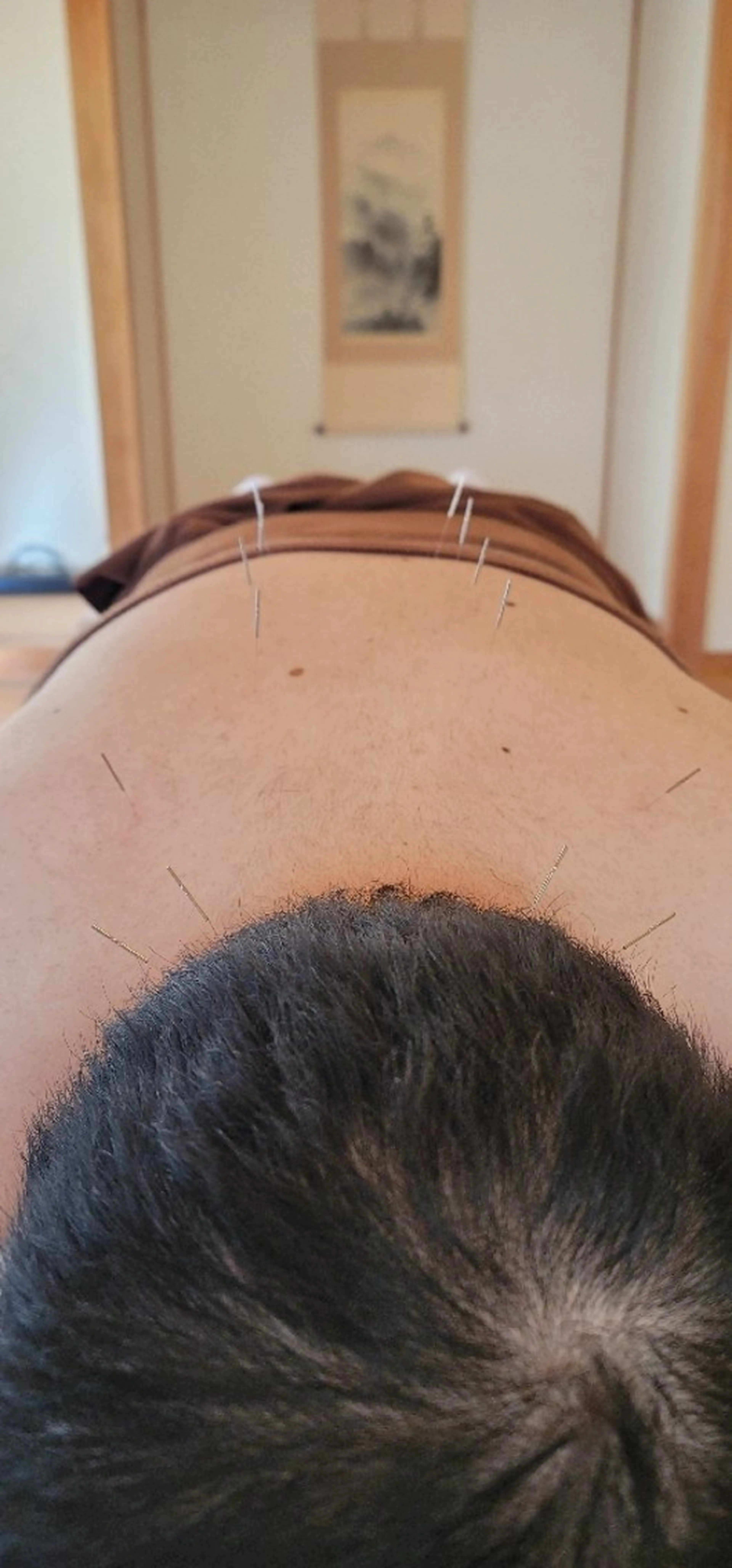 リラク なかむら鍼灸院所属・なかむら 鍼灸院のエステ・リラクイメージ