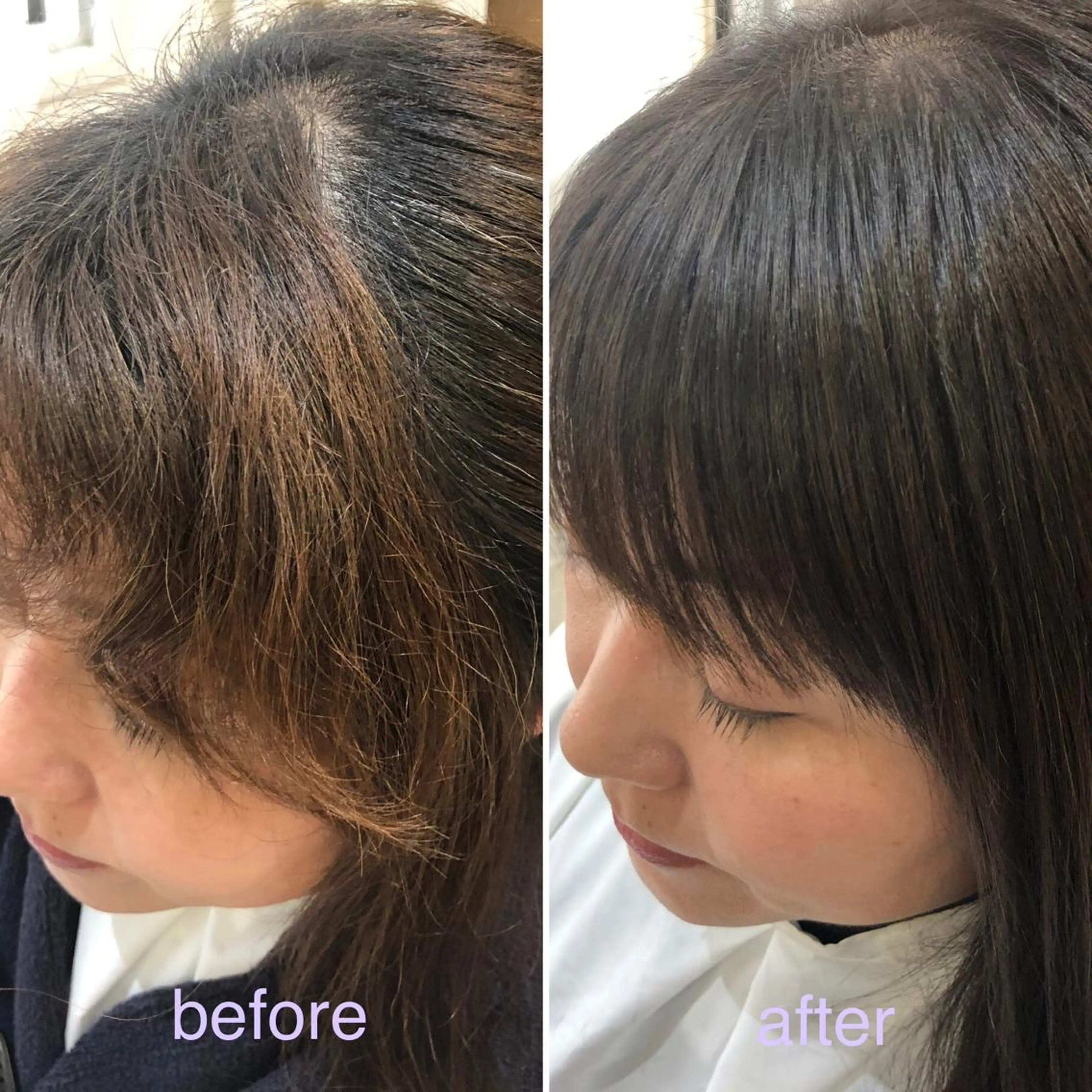 ミディアム くせ毛 縮毛矯正 hair salon Arllon(アルロン)所属・酸性縮毛矯正　美髪 特化サロン　八百村のヘアスタイル