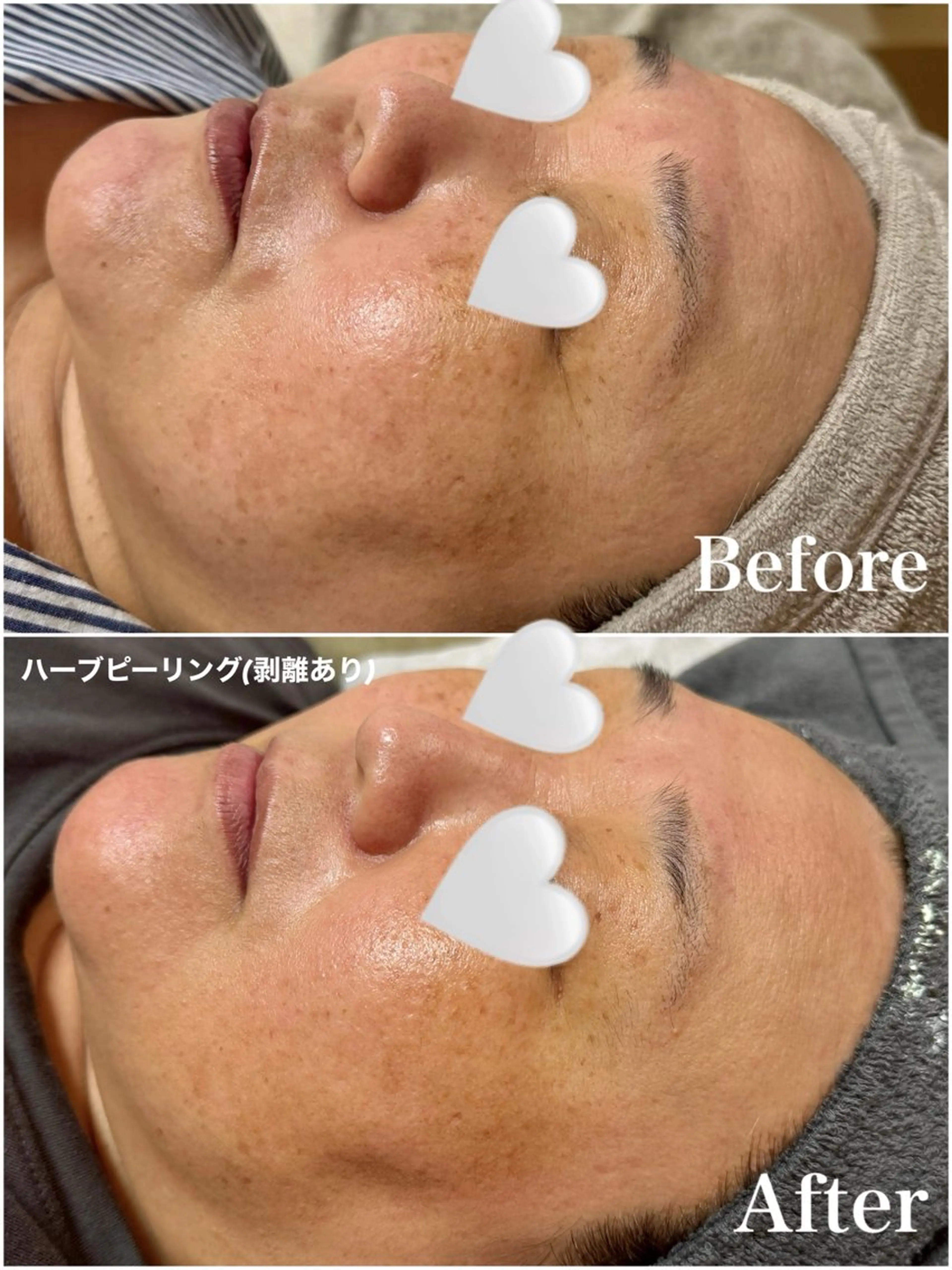 Ayaka🤍 恵比寿/美容鍼/整体のエステ・リラクイメージ