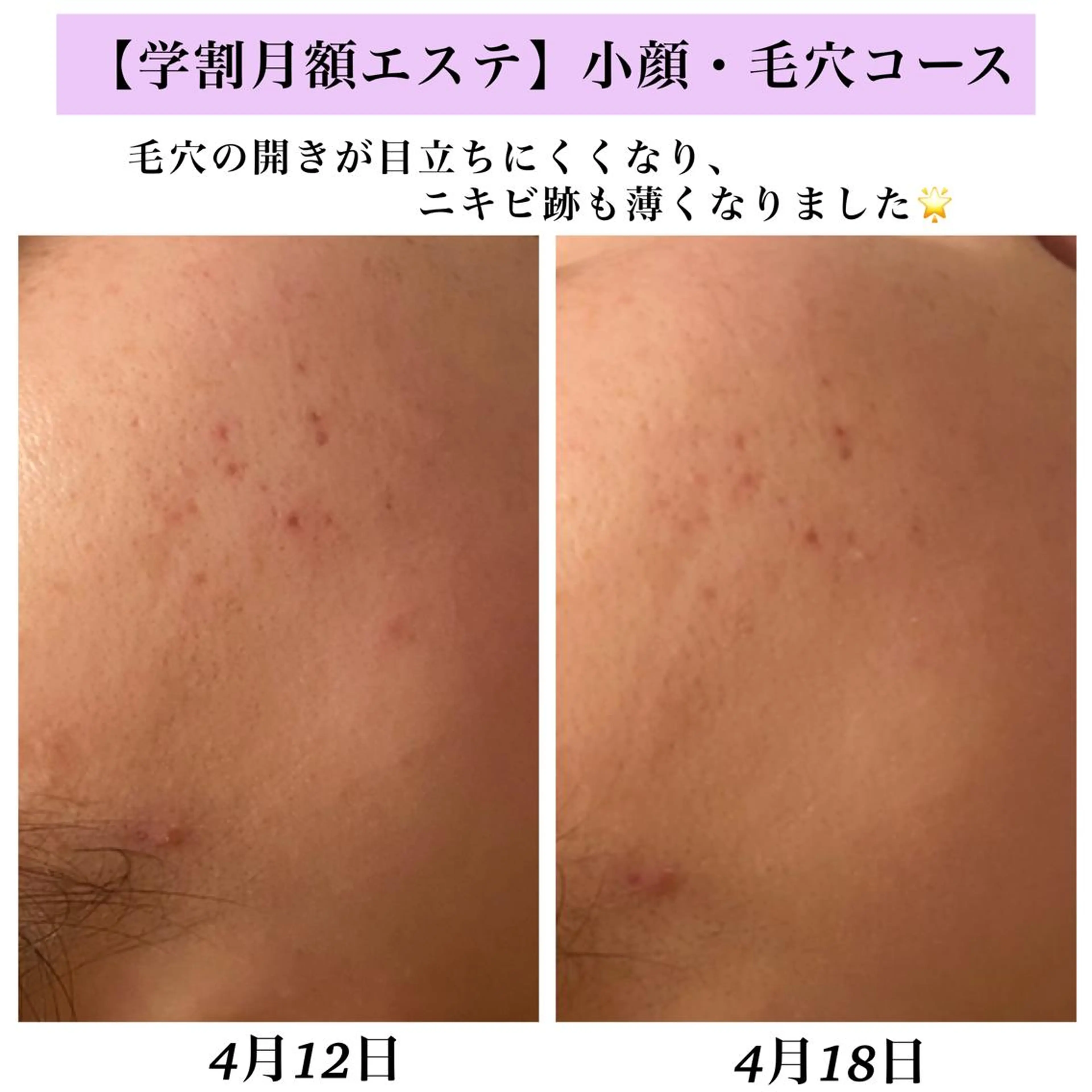 Bellesthe (ベルエステ)のエステ・リラクイメージ