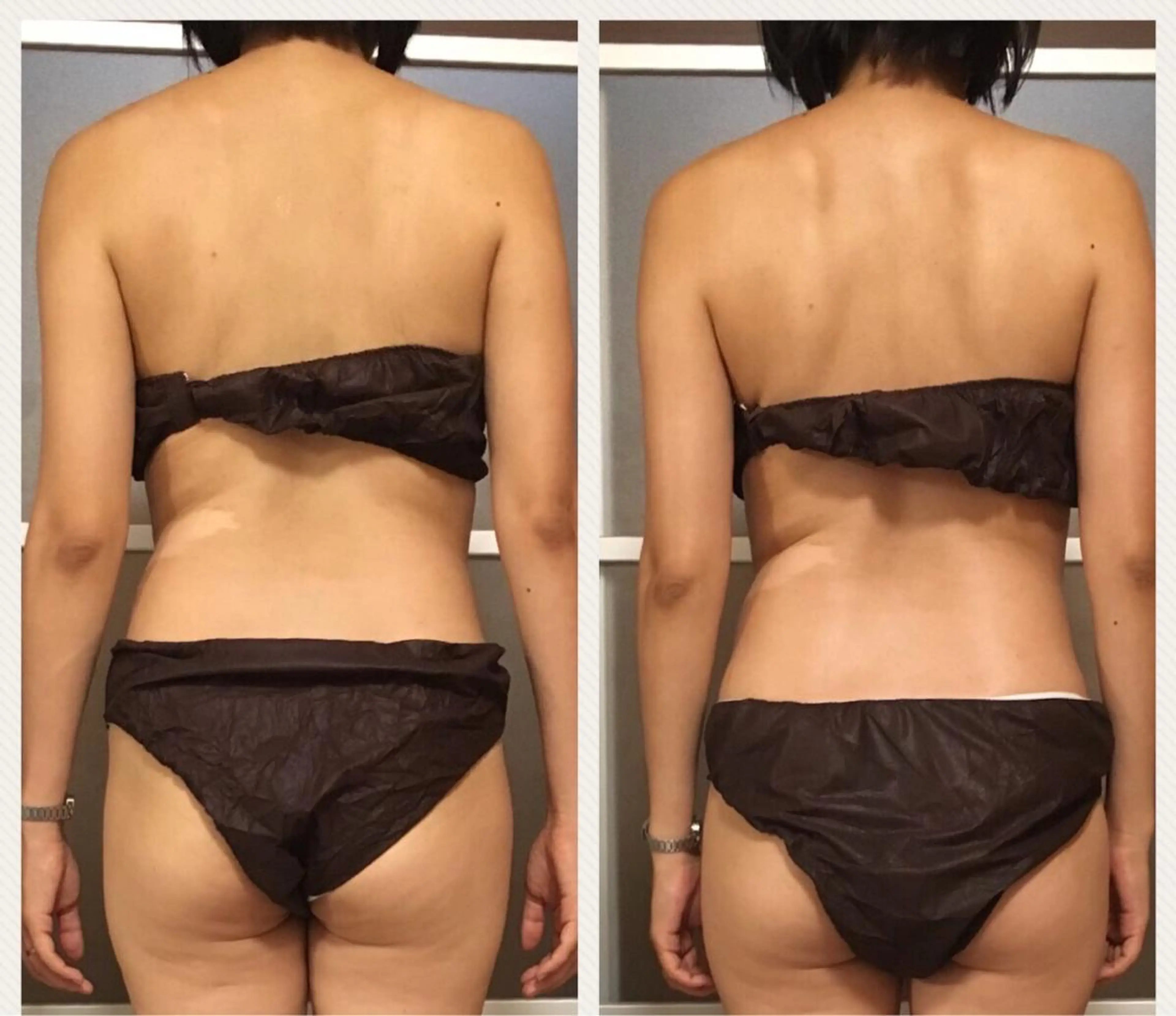 ミディアム カラー パーマ ヘアアレンジ メンズ キッズ ネイル マツエク・マツパ アニメ,Vオタク× 即効痩せエステサロンのエステ・リラクイメージ