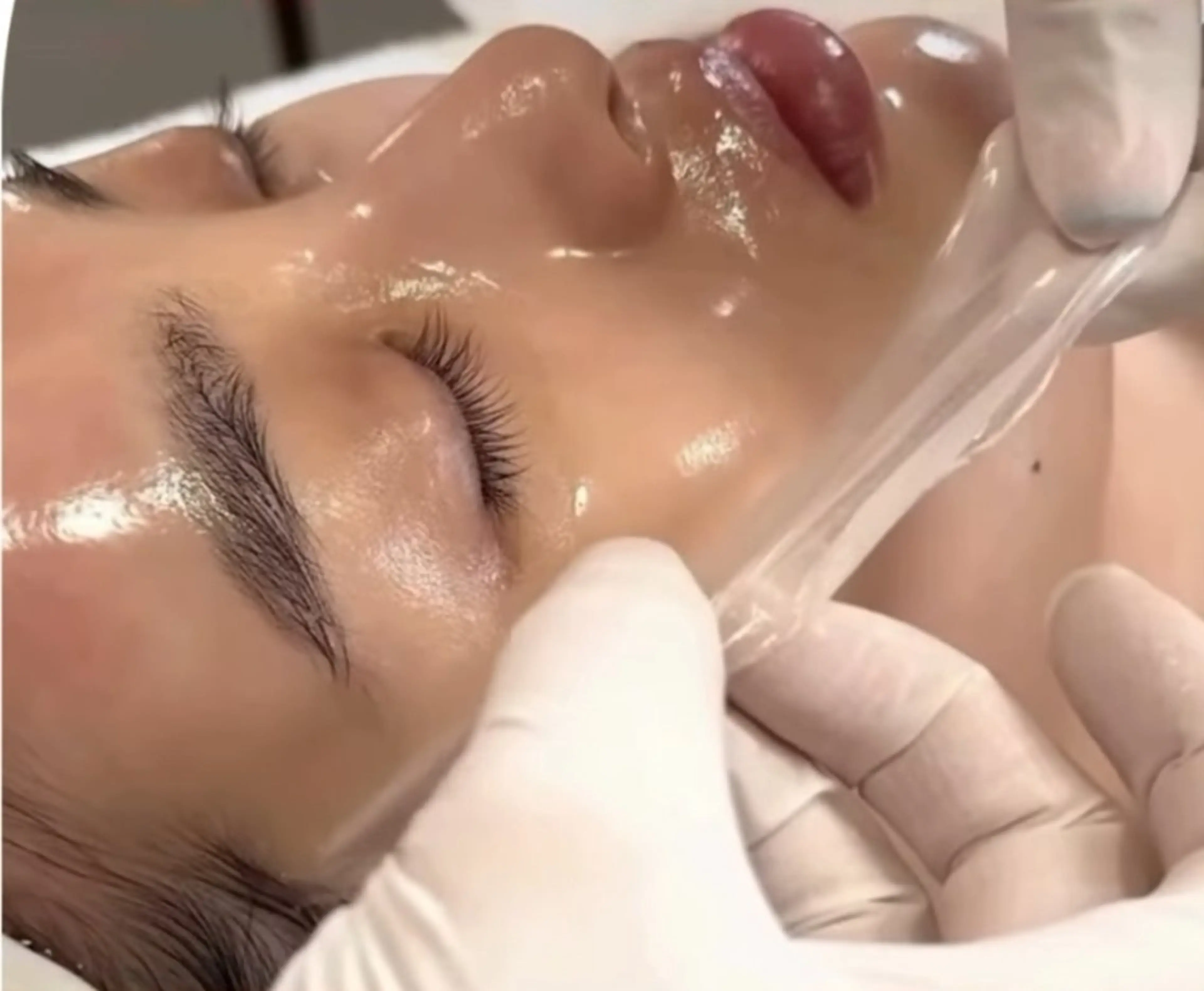 【期間限定割引☆】韓国艶肌小顔コース￥20,000→￥16,800の写真