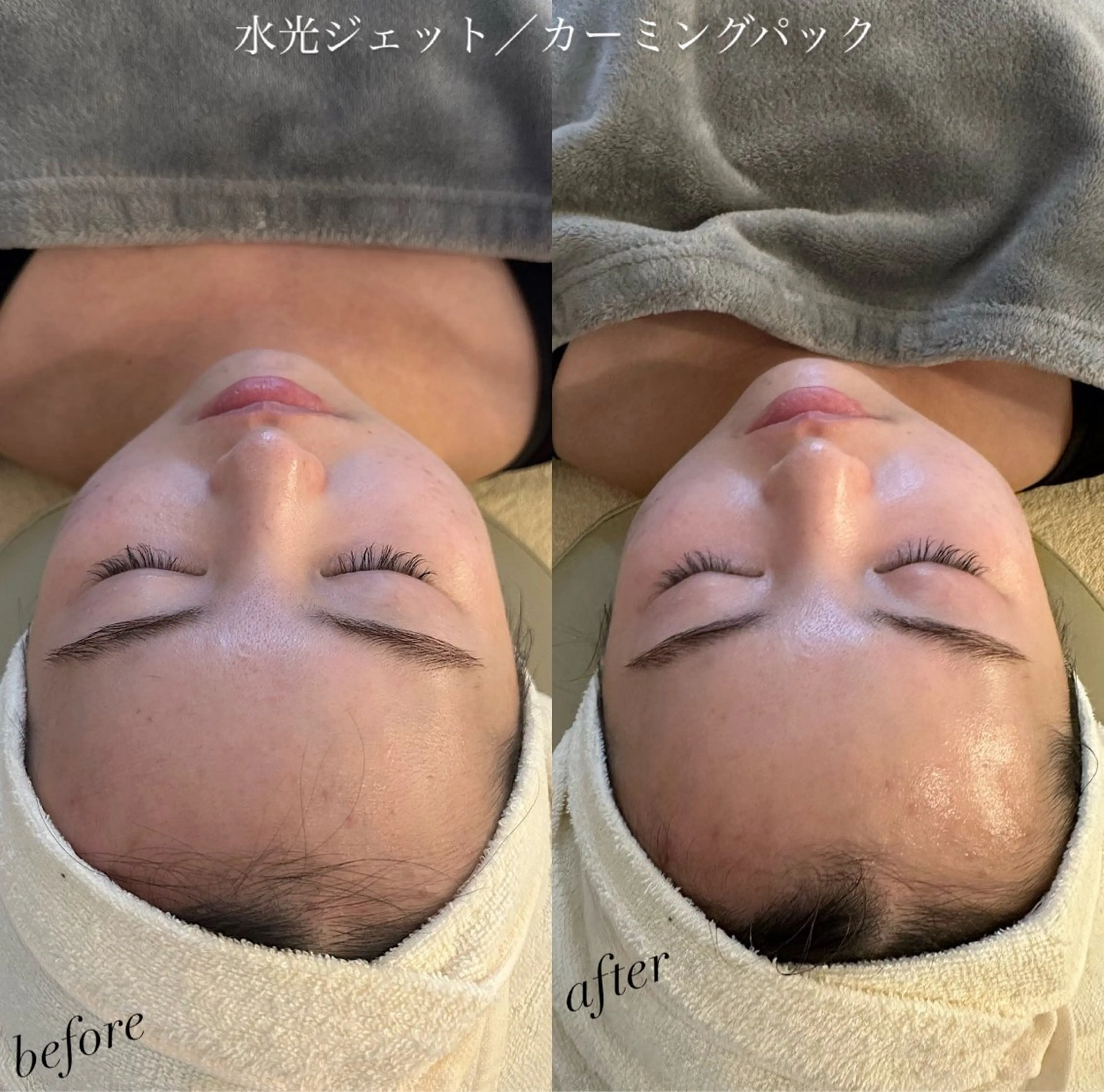 うなじ脱毛/美肌脱毛 LABELのエステ・リラクイメージ