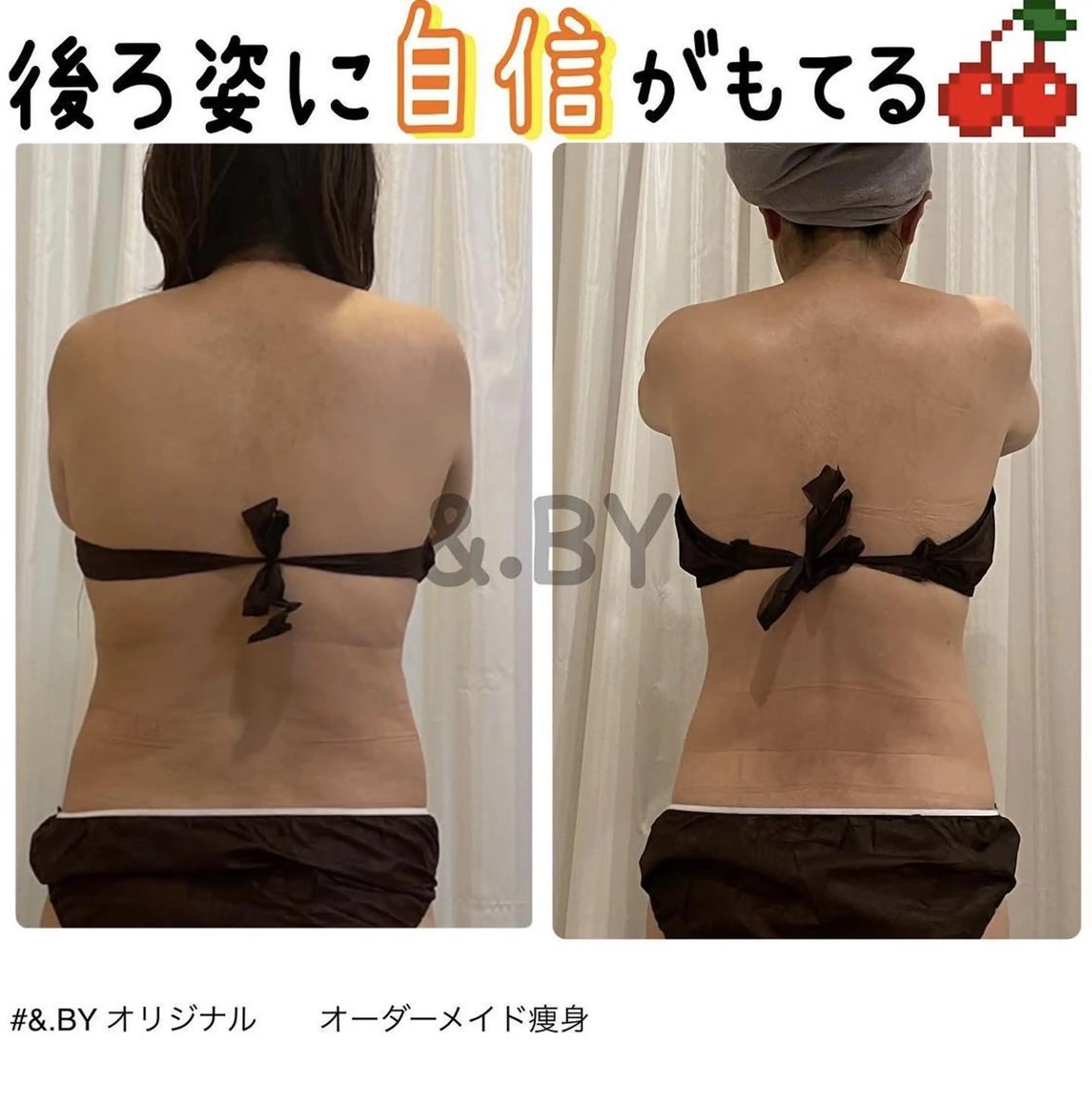 12月限定【分解×燃焼×排出】　全身ガッツリ痩身　70min¥4,400の写真