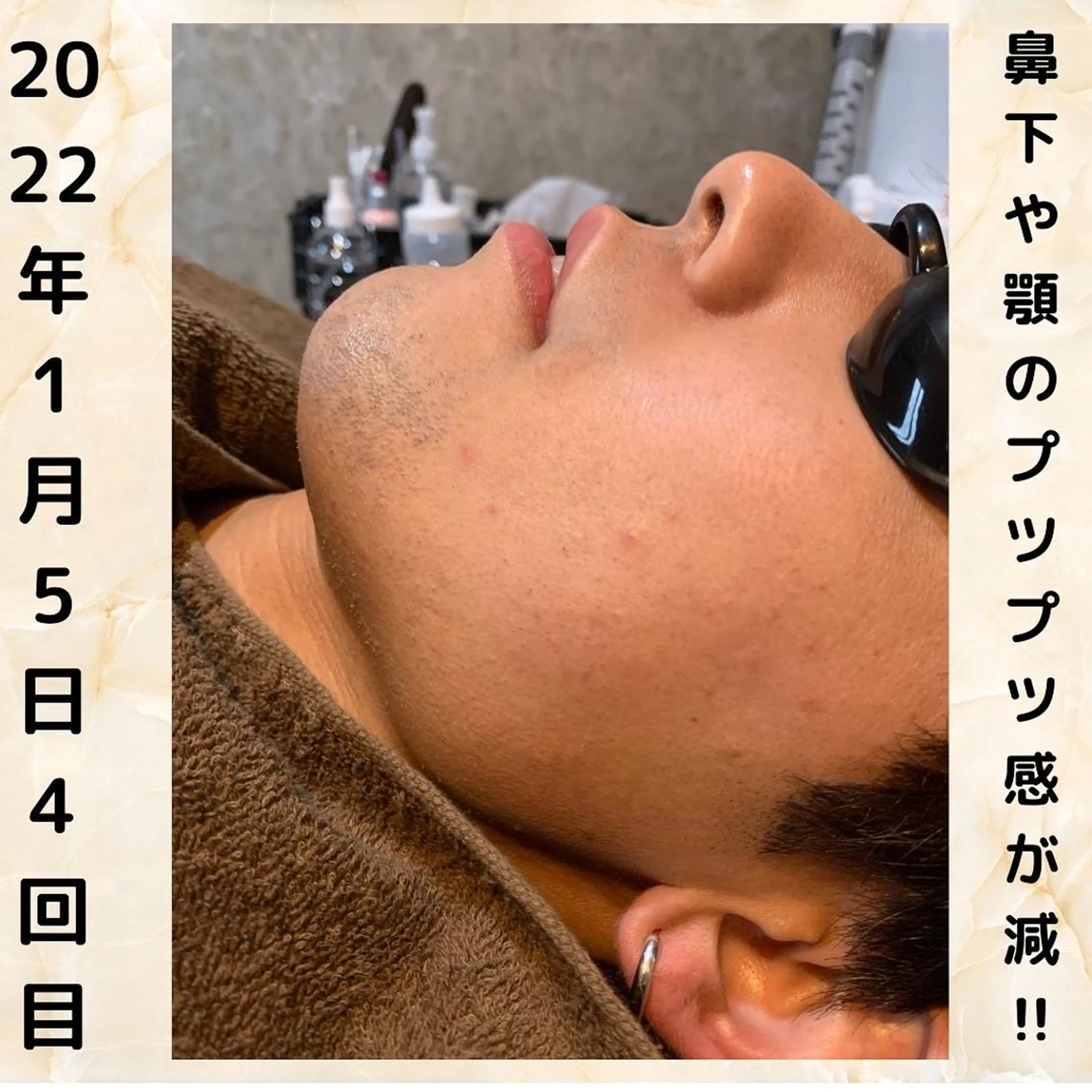 メンズ 20代から始める脱毛 salonLEPIAのエステ・リラクイメージ