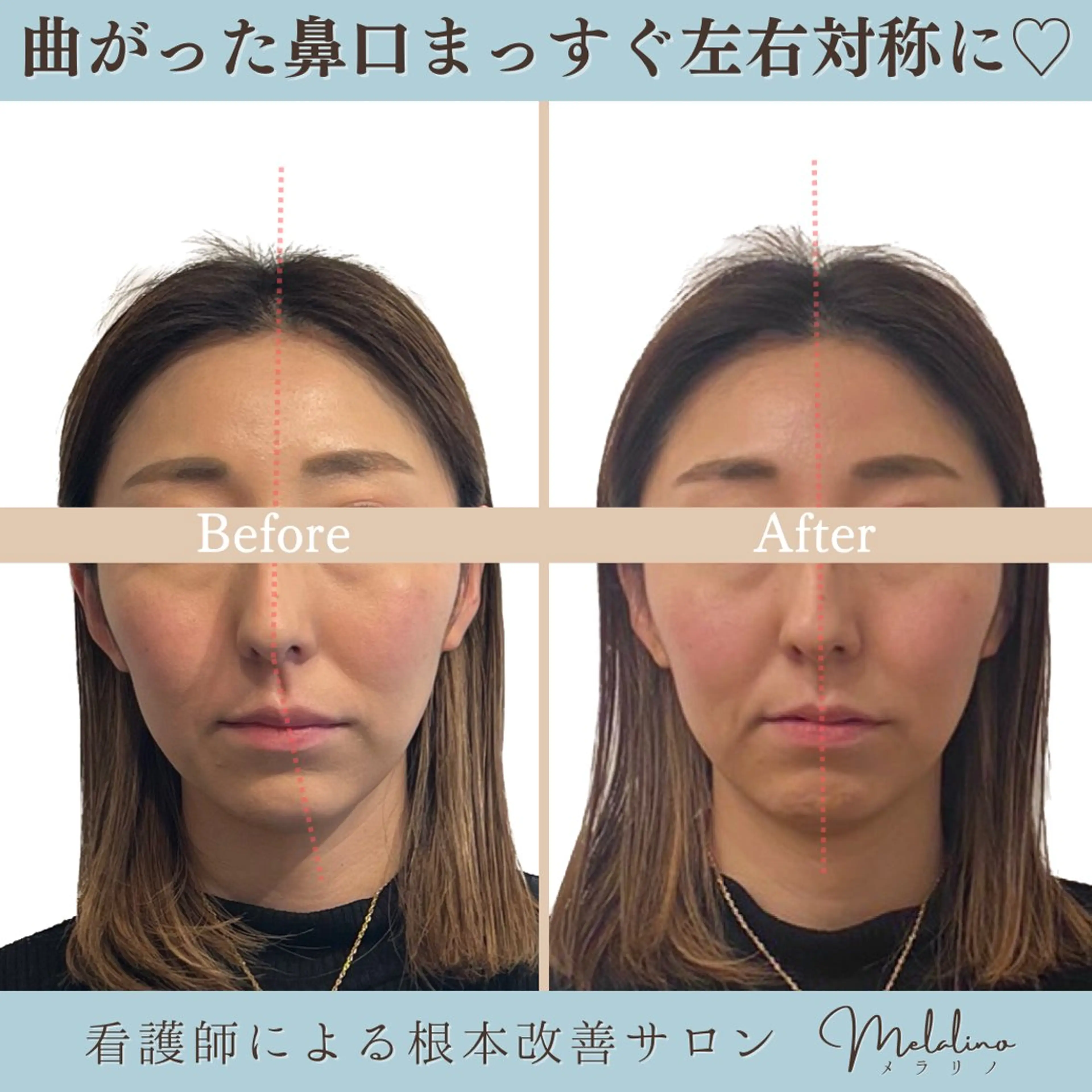 美容整体サロン Melalinoのエステ・リラクイメージ