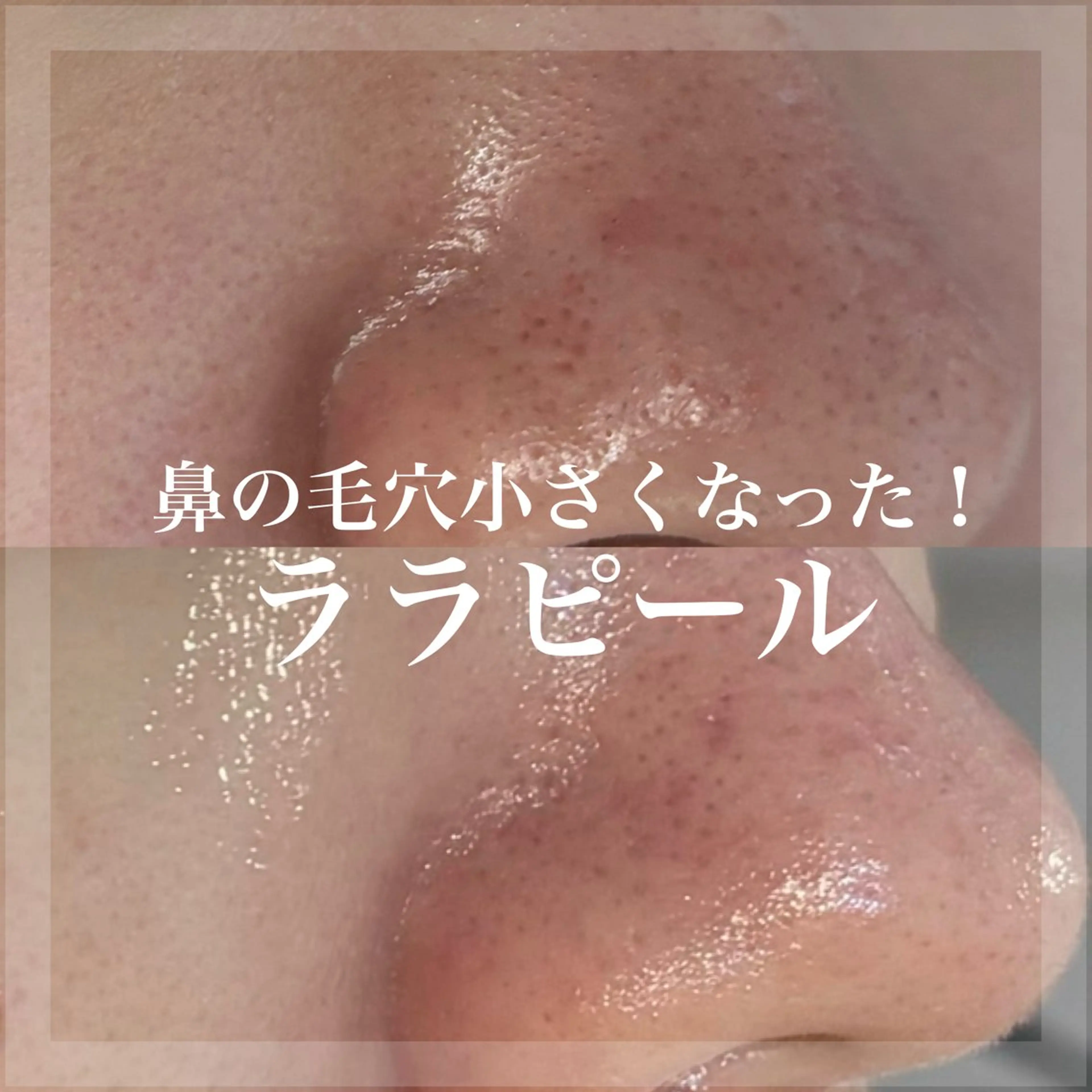 エステ WHITE AQUA 北千住店のエステ・リラクイメージ