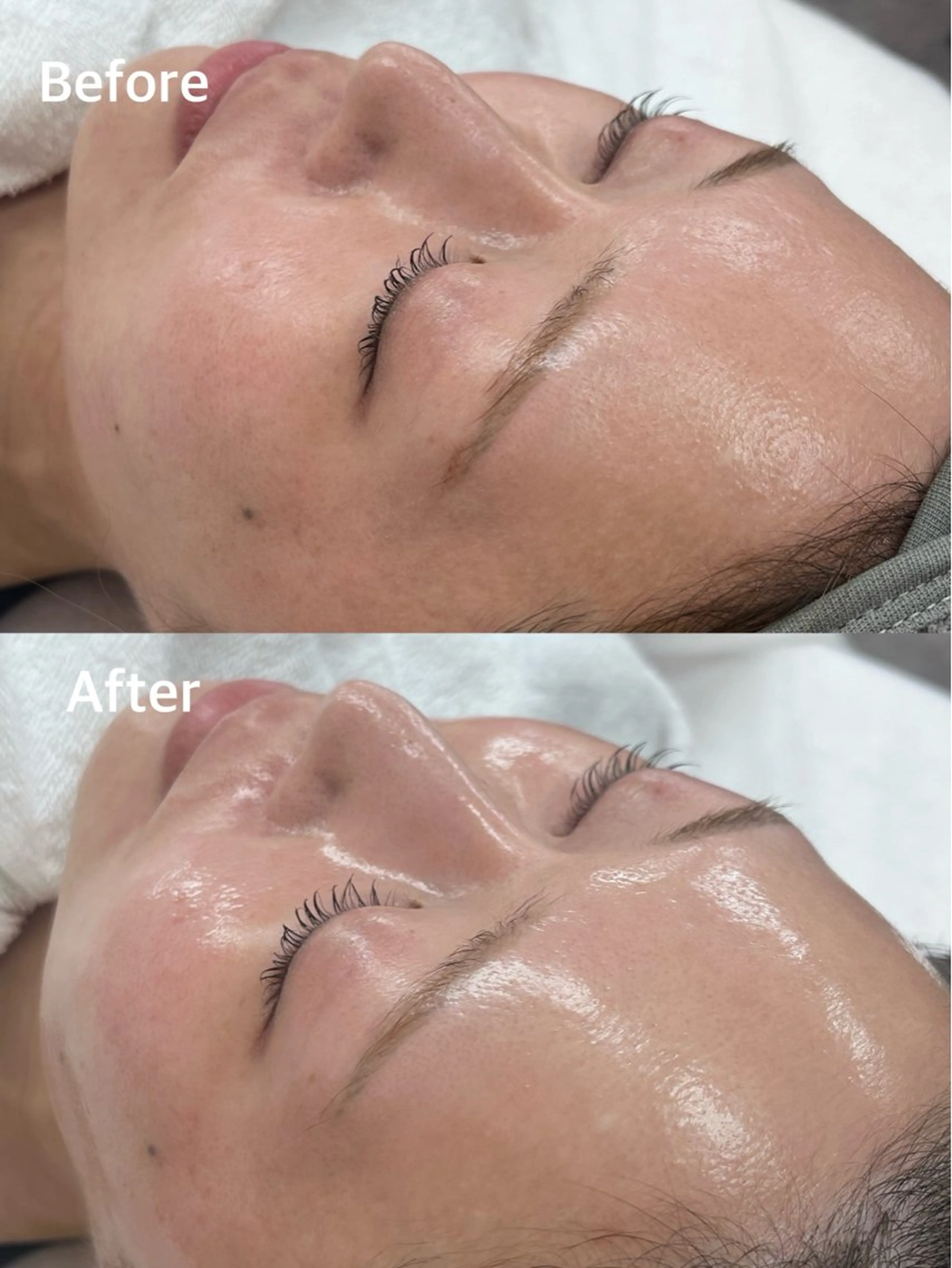 脱毛 クラスペディア脱毛 ・フェイシャル専門店のエステ・リラクイメージ