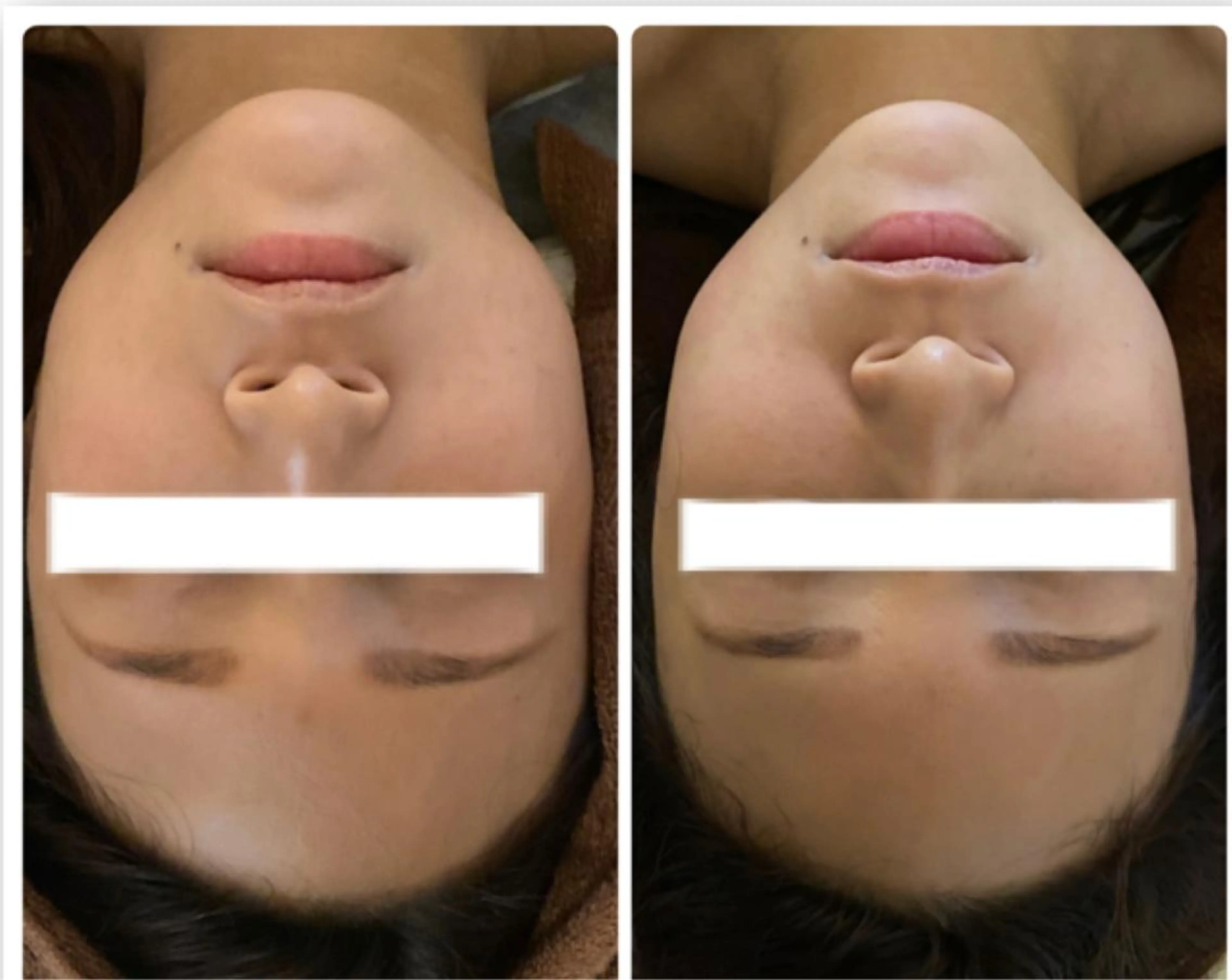 FLEUR大阪・整体 ・ハイフ・痩身・小顔のエステ・リラクイメージ