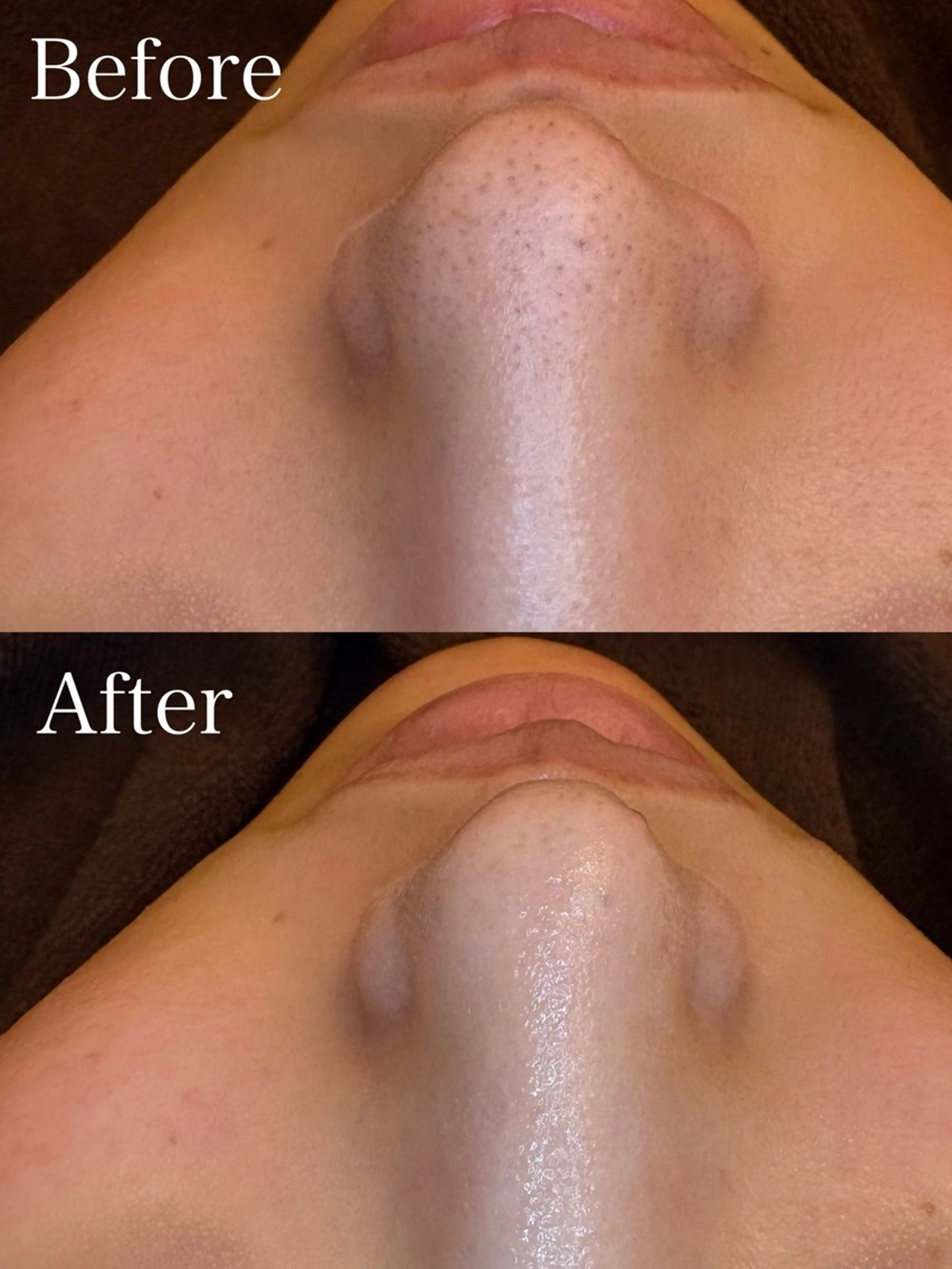 エステ EARTH coiffure beaute 新潟紫竹山店所属・🤍アベシュリ /フェイシャル🤍のエステ・リラクイメージ