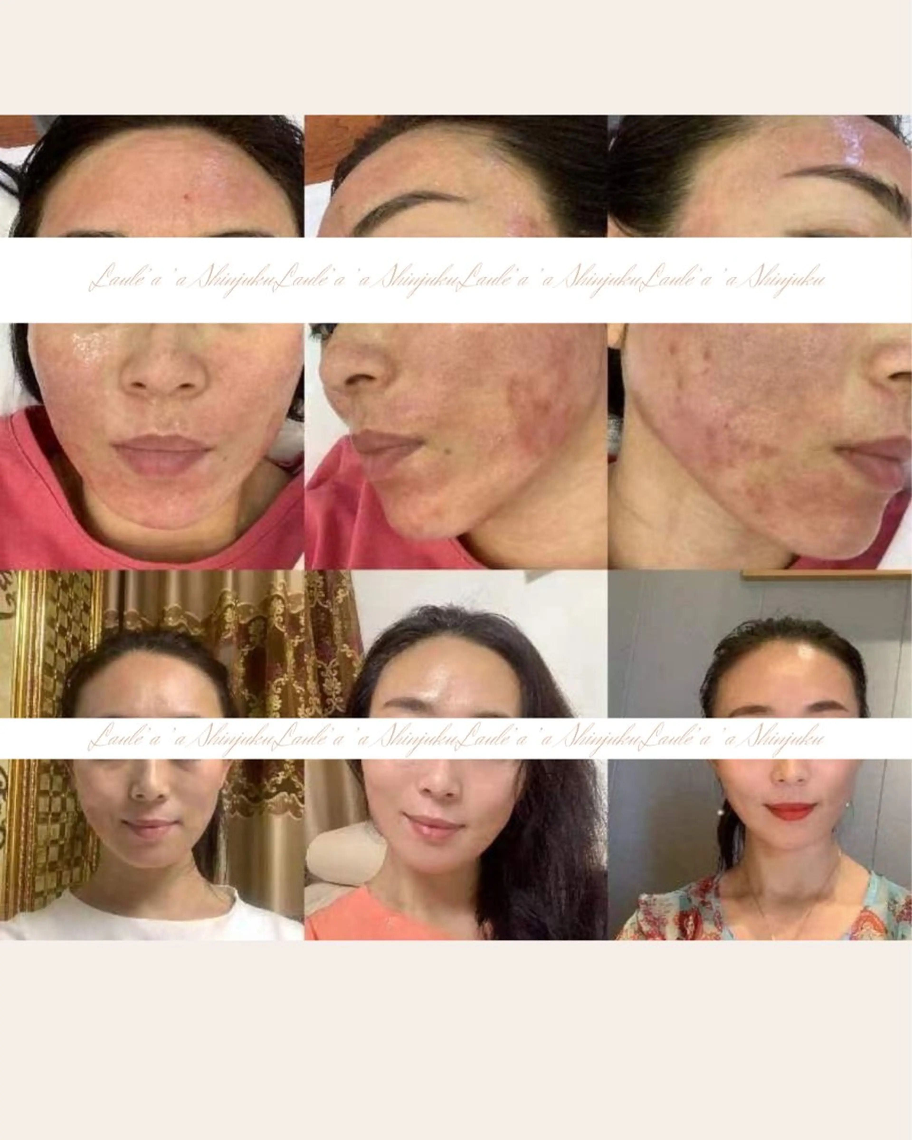 痩身/腸もみ/ ヘッドスパ/リンパのエステ・リラクイメージ