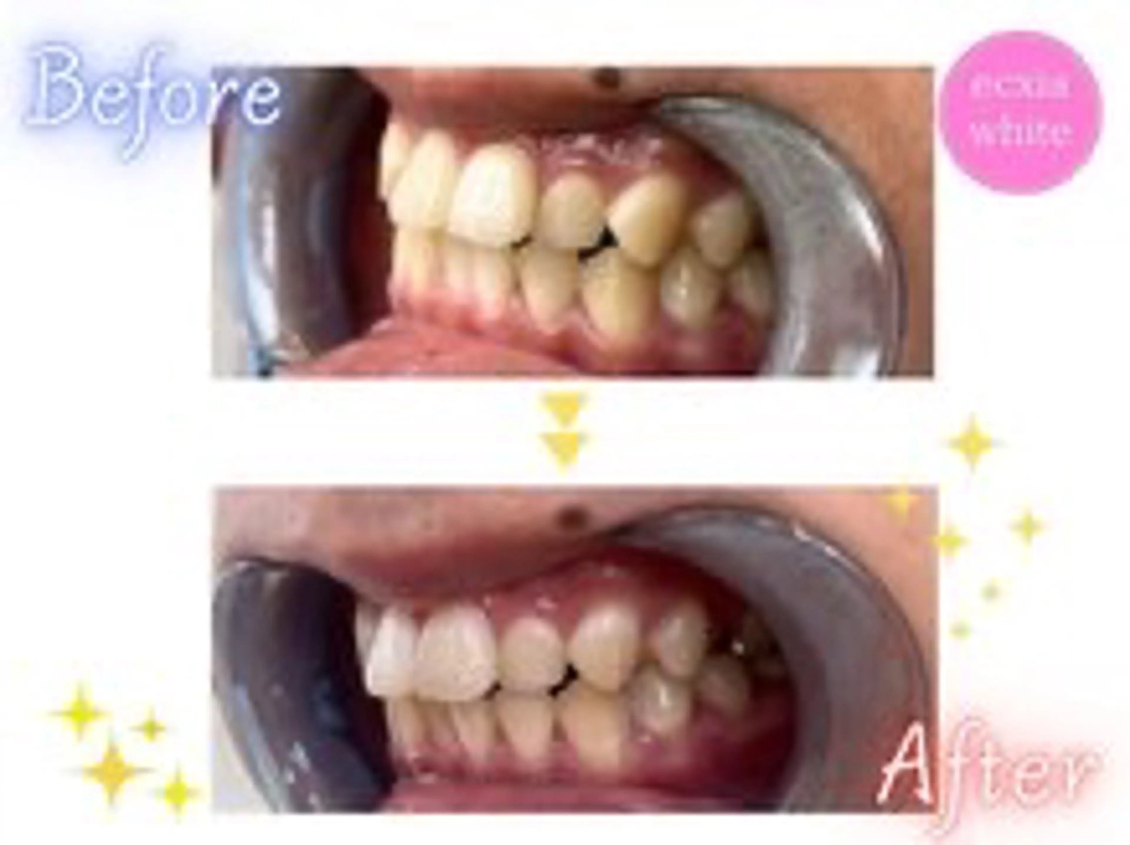 ecxia white 高田馬場所属・セルフホワイトニング エクシア 高田馬場のその他イメージ