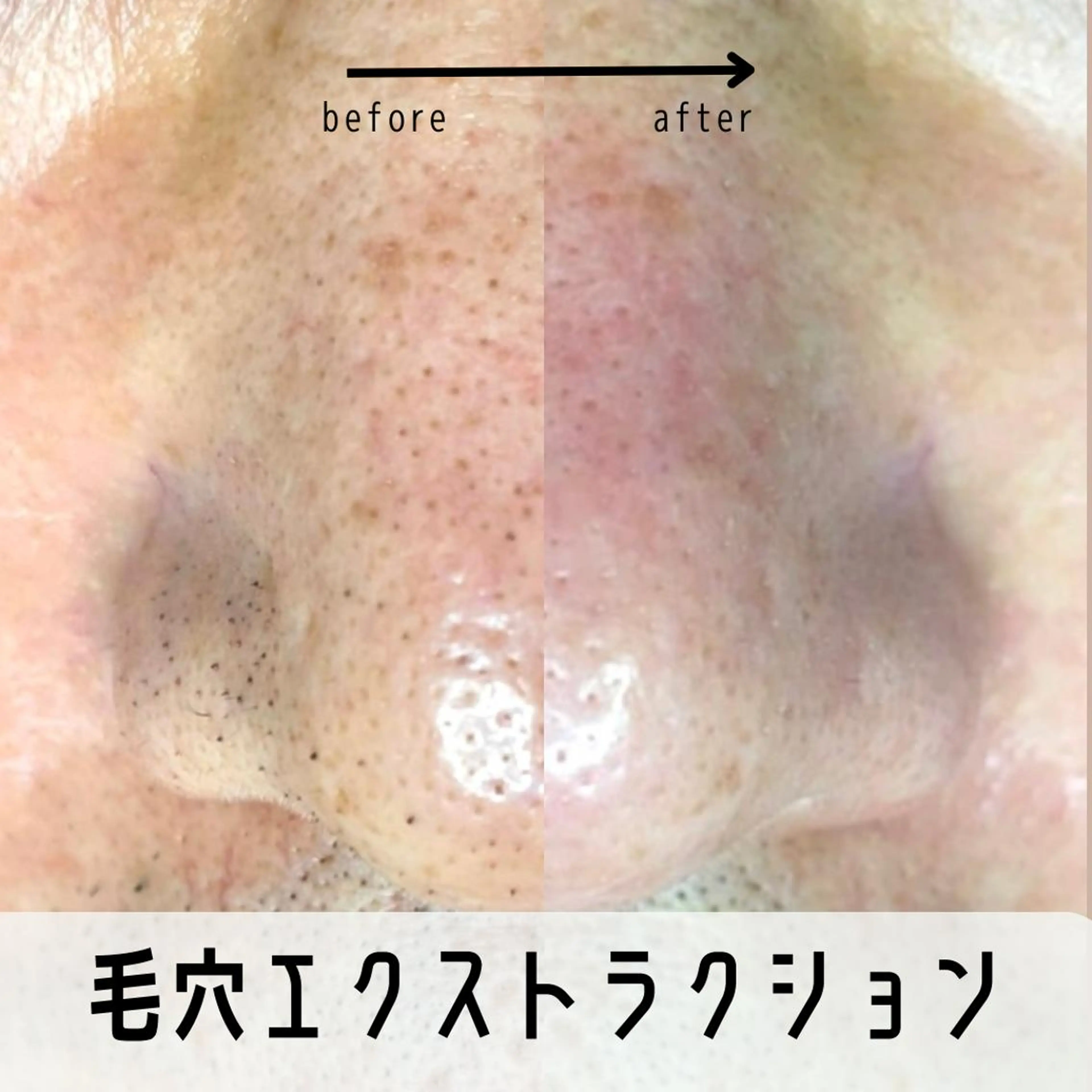 Muqu.所属・Muqu. 毛穴サロンのエステ・リラクイメージ