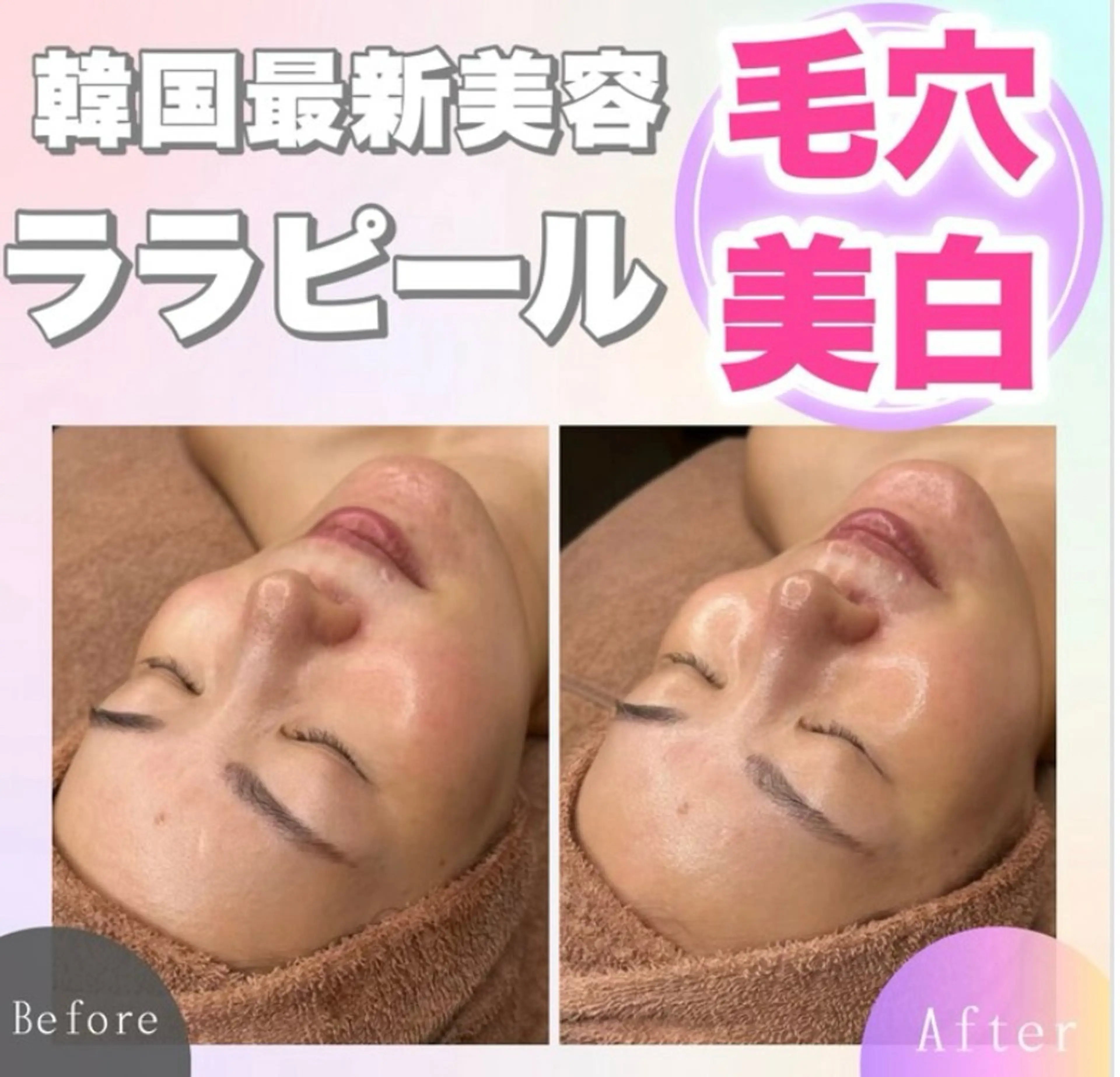 8月ミニモ限定価格‼️】韓国最新美容🫧ララピール🫧✅次回10%割引付き!の写真