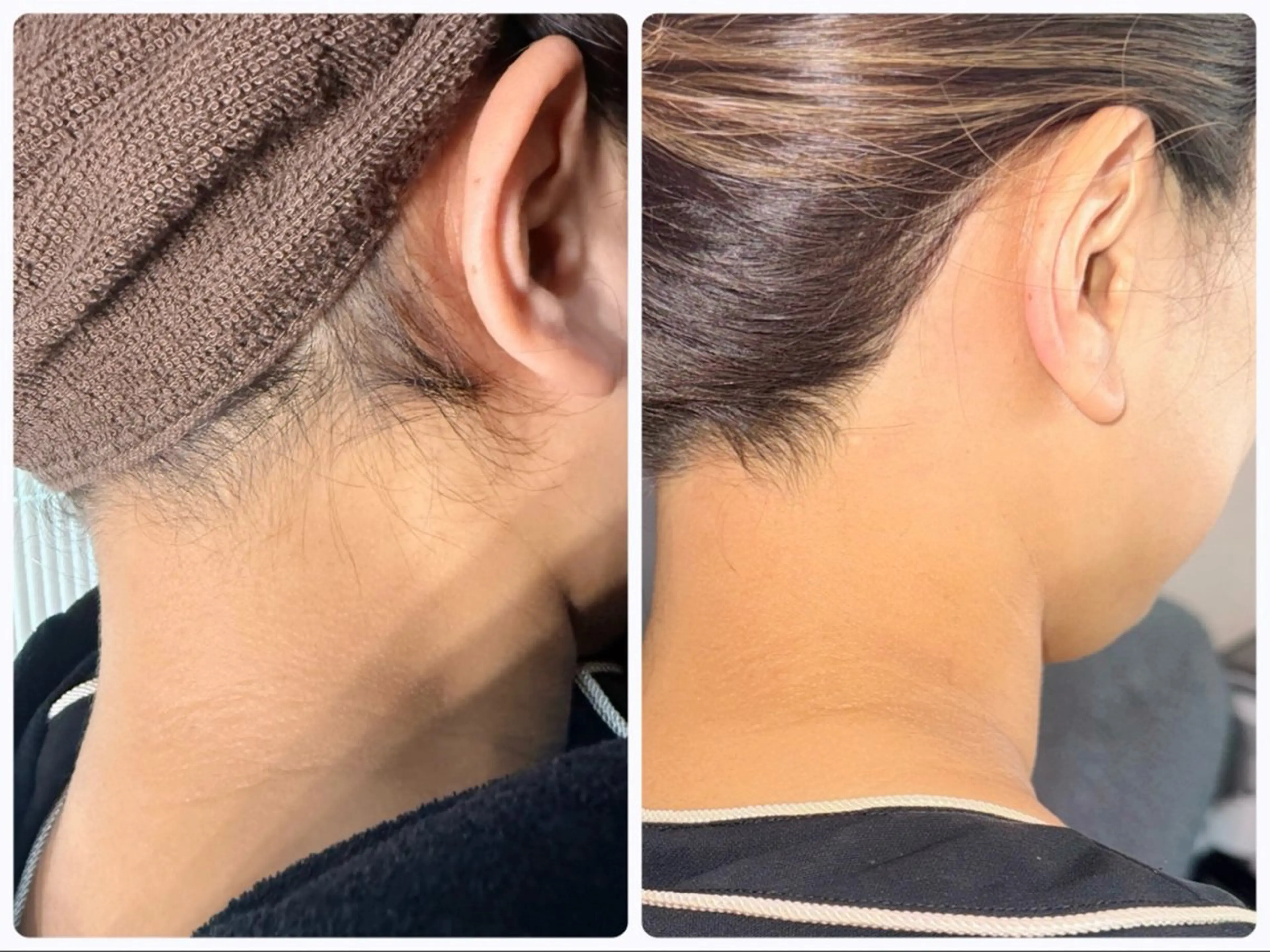 脱毛 M’s Beauty所属・M's Beautyのエステ・リラクイメージ