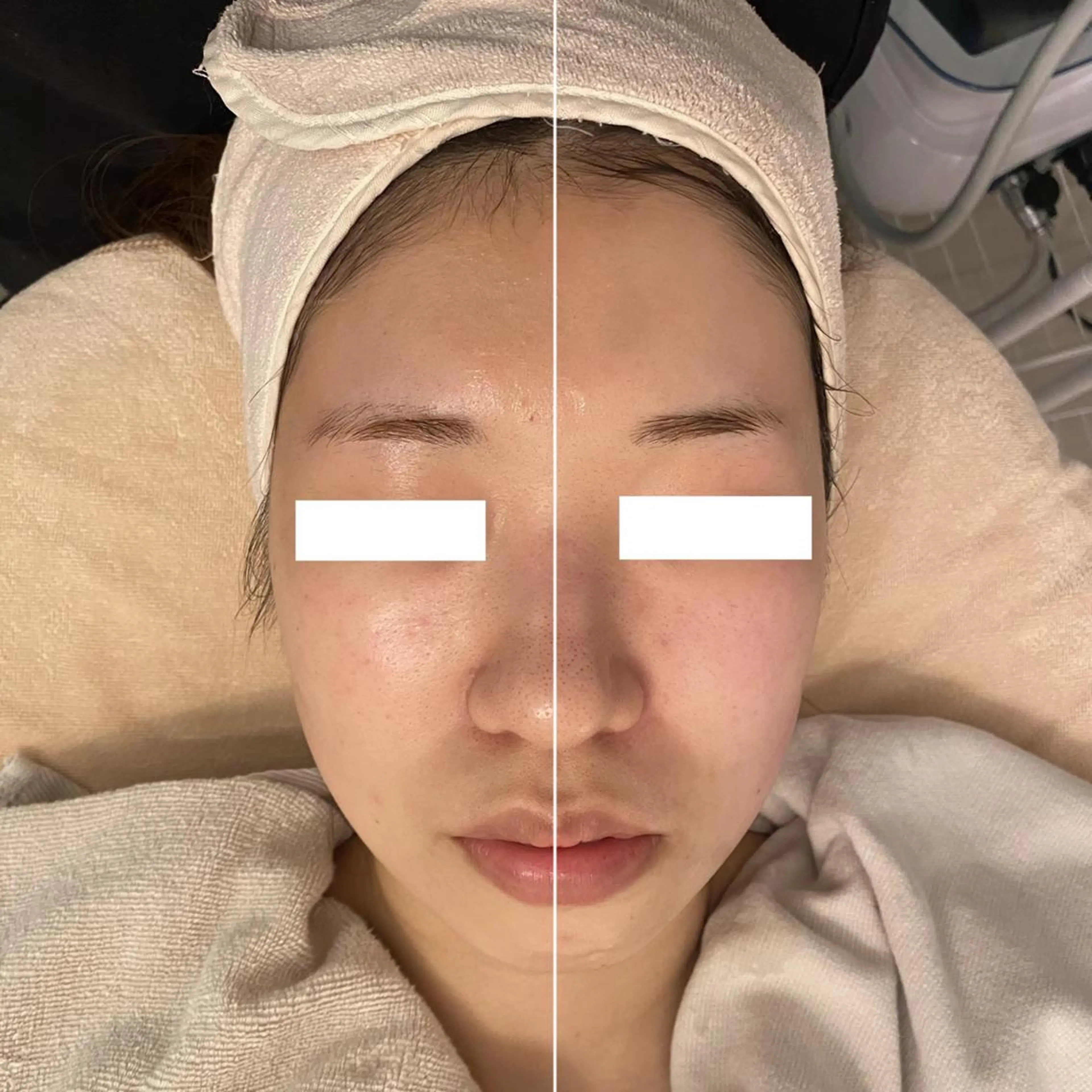 ✨美肌水光✨ アトリエリュバンのエステ・リラクイメージ