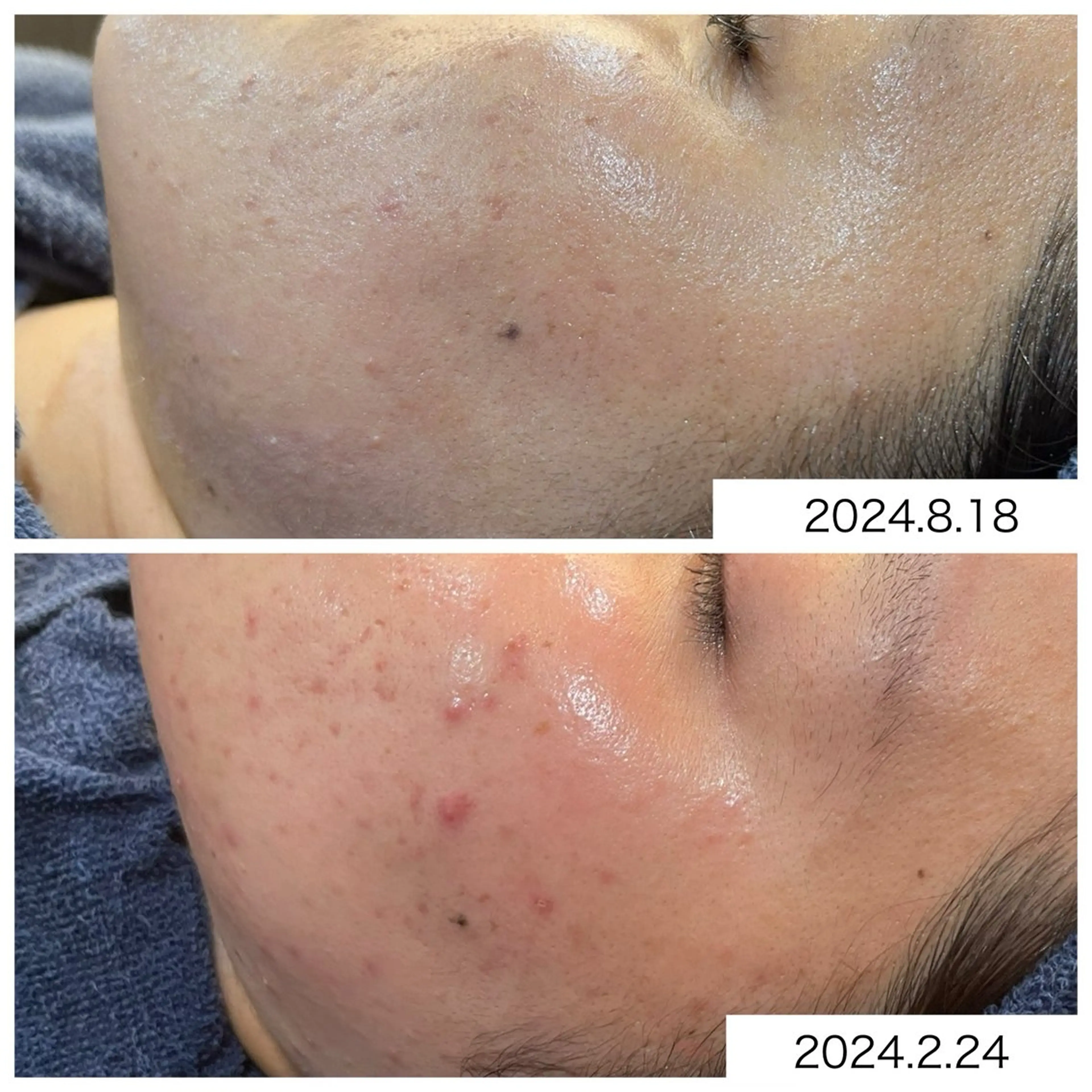 leolo武蔵浦和 肌質改善&脱毛のエステ・リラクイメージ