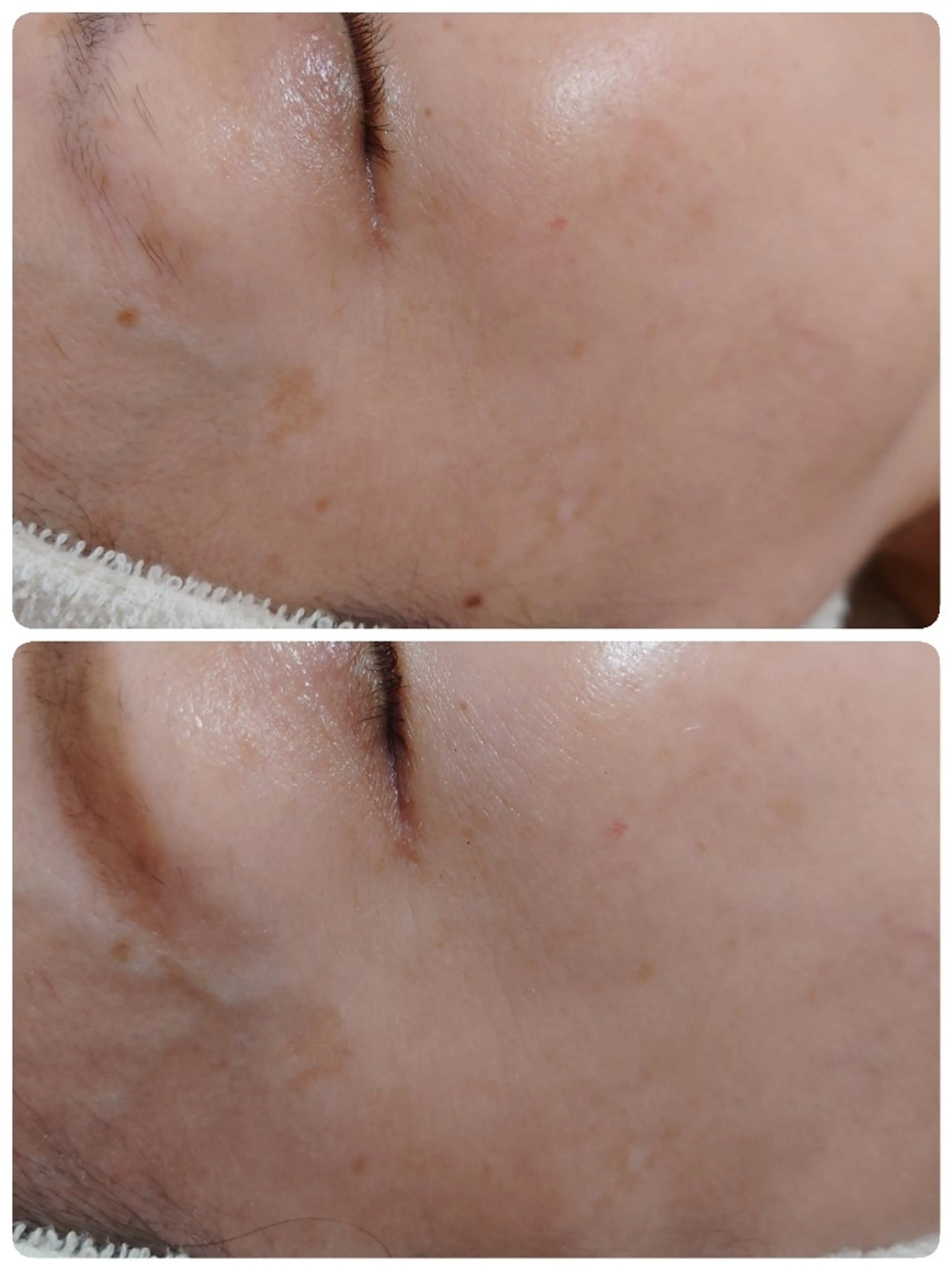 エステ Abe Yukaのエステ・リラクイメージ