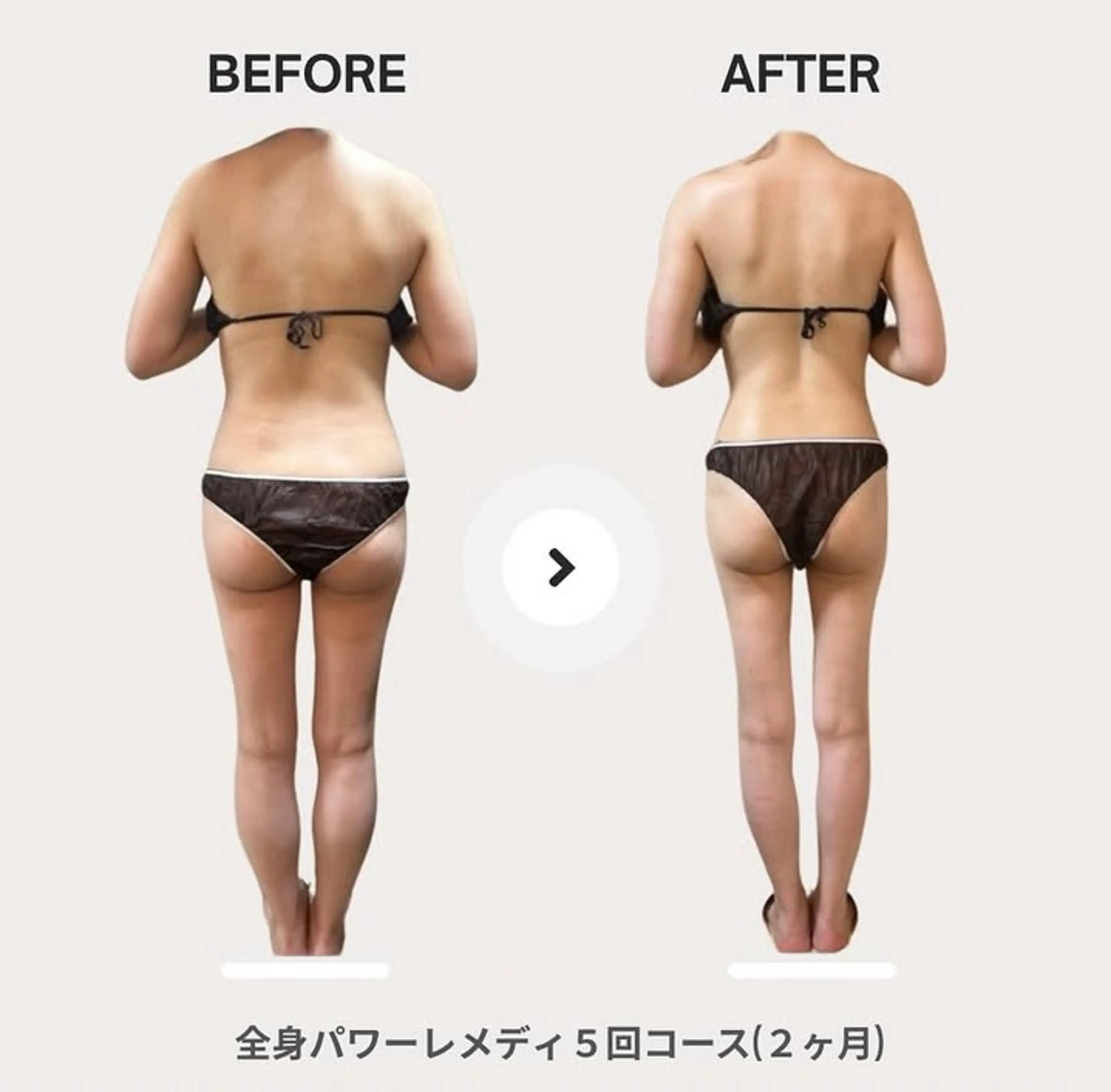 エステ リラク biloop所属・《痩身×疲労改善》 BILOOPのエステ・リラクイメージ