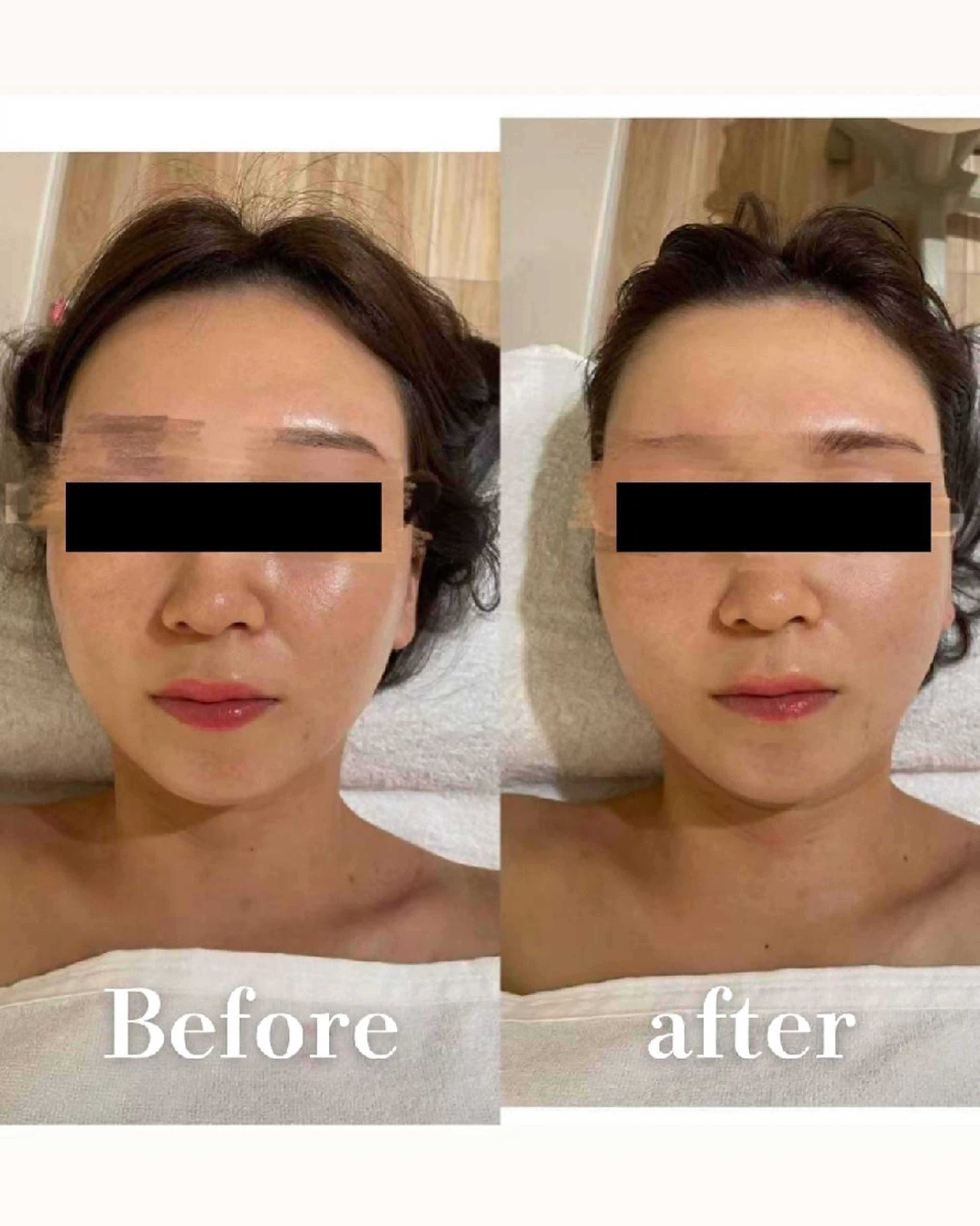 高岳/久屋大通 脱毛 コルギ🌿ENSHIのエステ・リラクイメージ