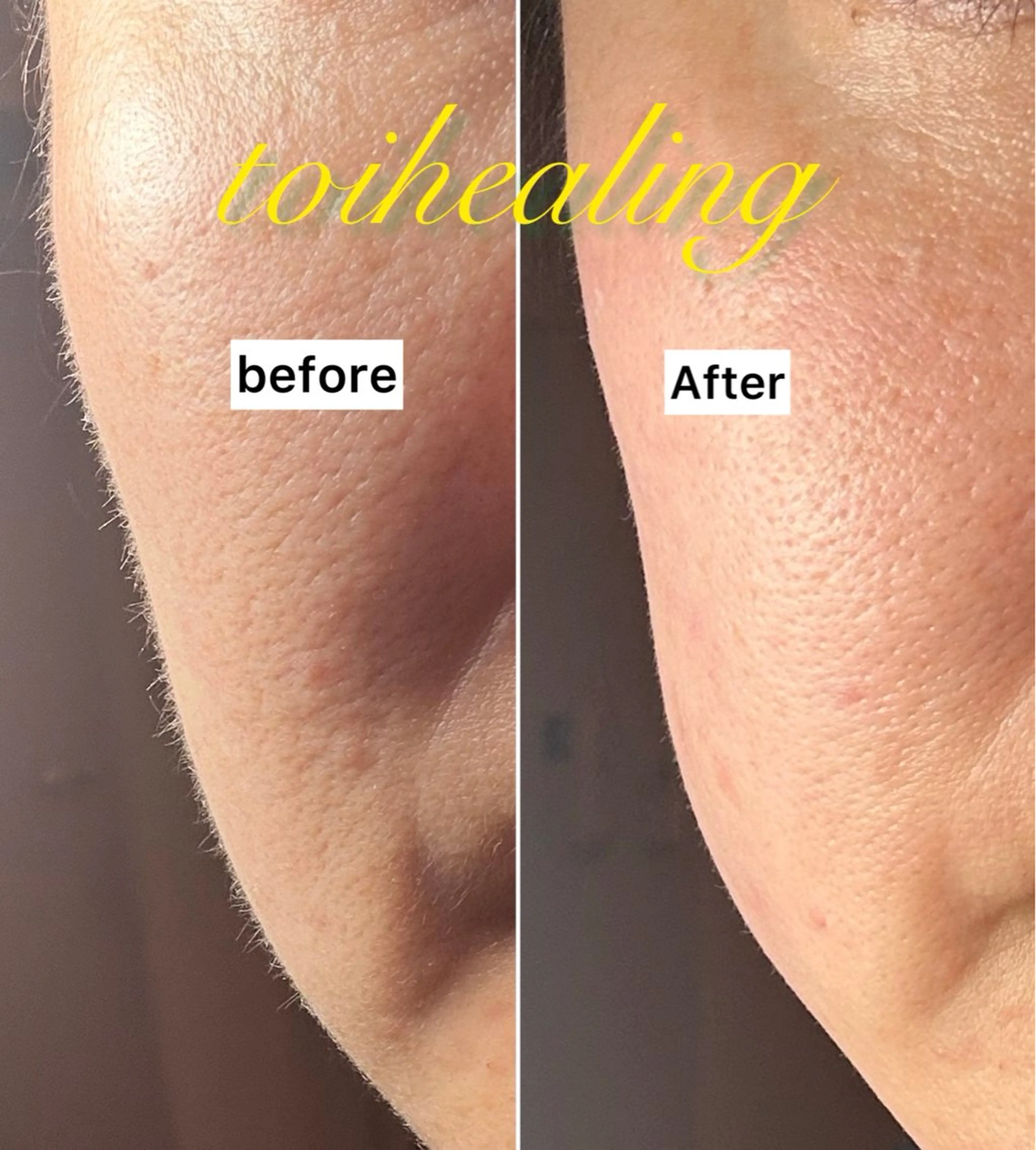 肌質改善サロン　toihealing所属・肌質改善サロン トワヒーリングのエステ・リラクイメージ