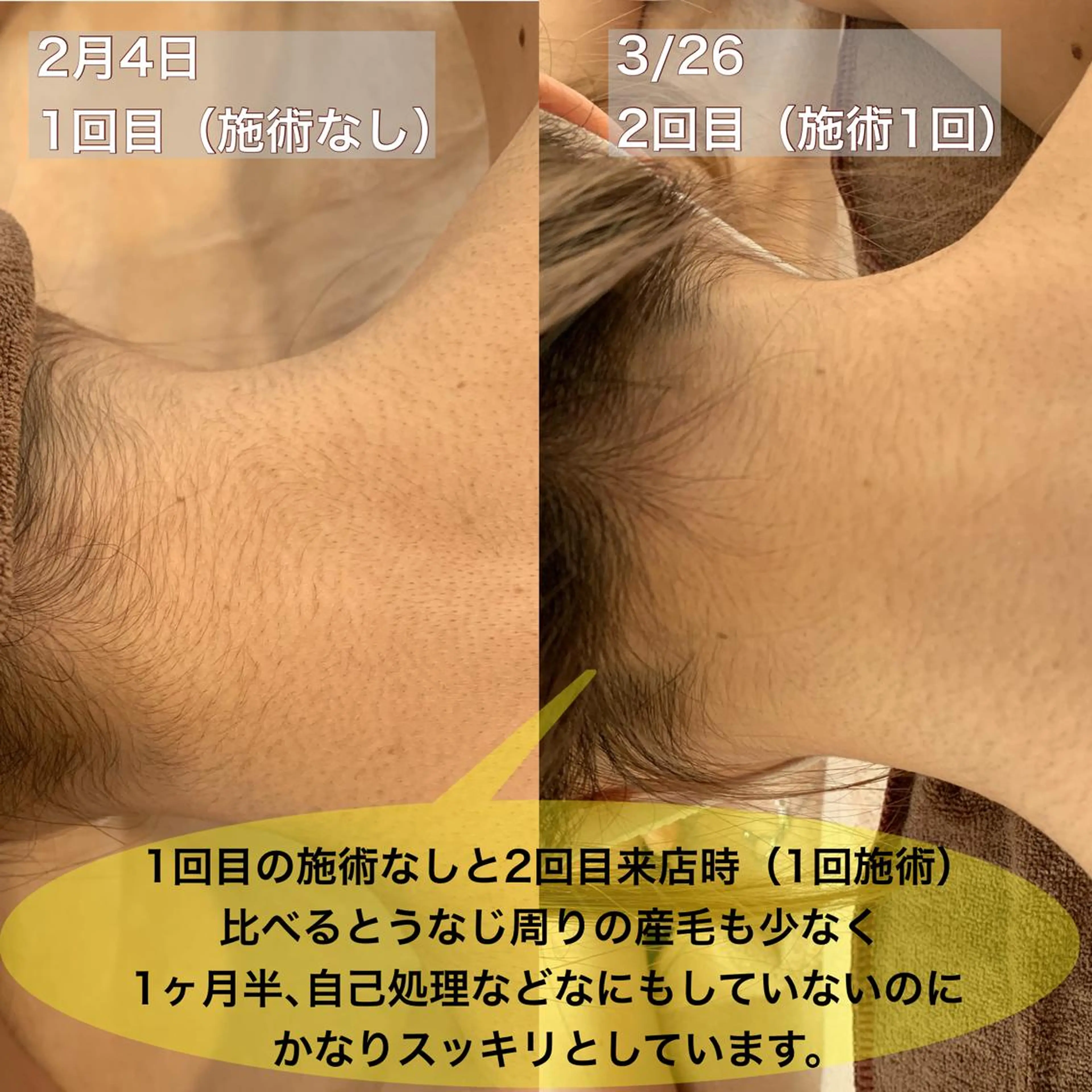 美肌コラーゲン脱毛SINCERITE【サンセリテ】所属・瀬野 のぞみのエステ・リラクイメージ