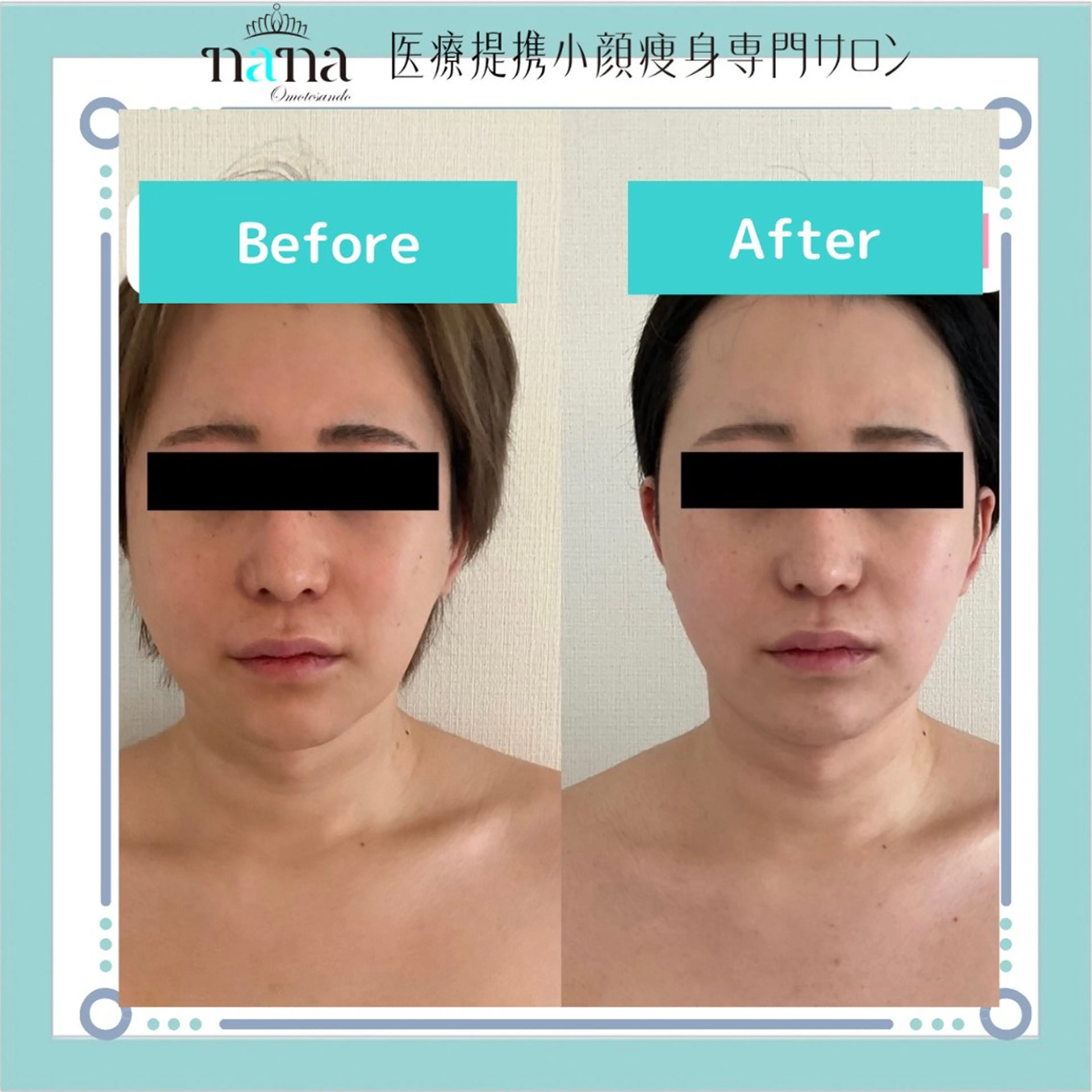 小顔痩身インディバ Nana表参道のエステ・リラクイメージ