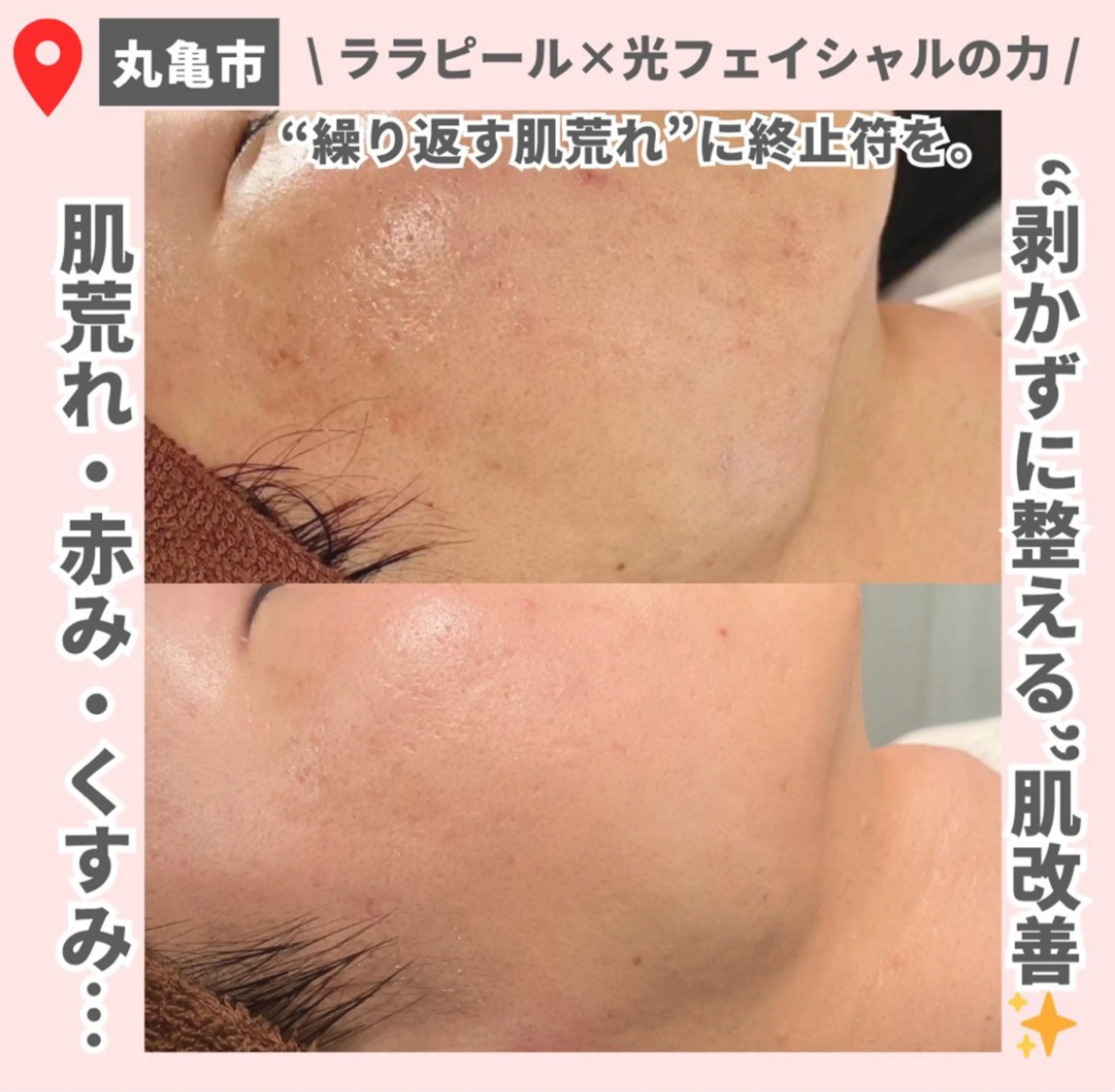 【LEPUS】 sekiのエステ・リラクイメージ