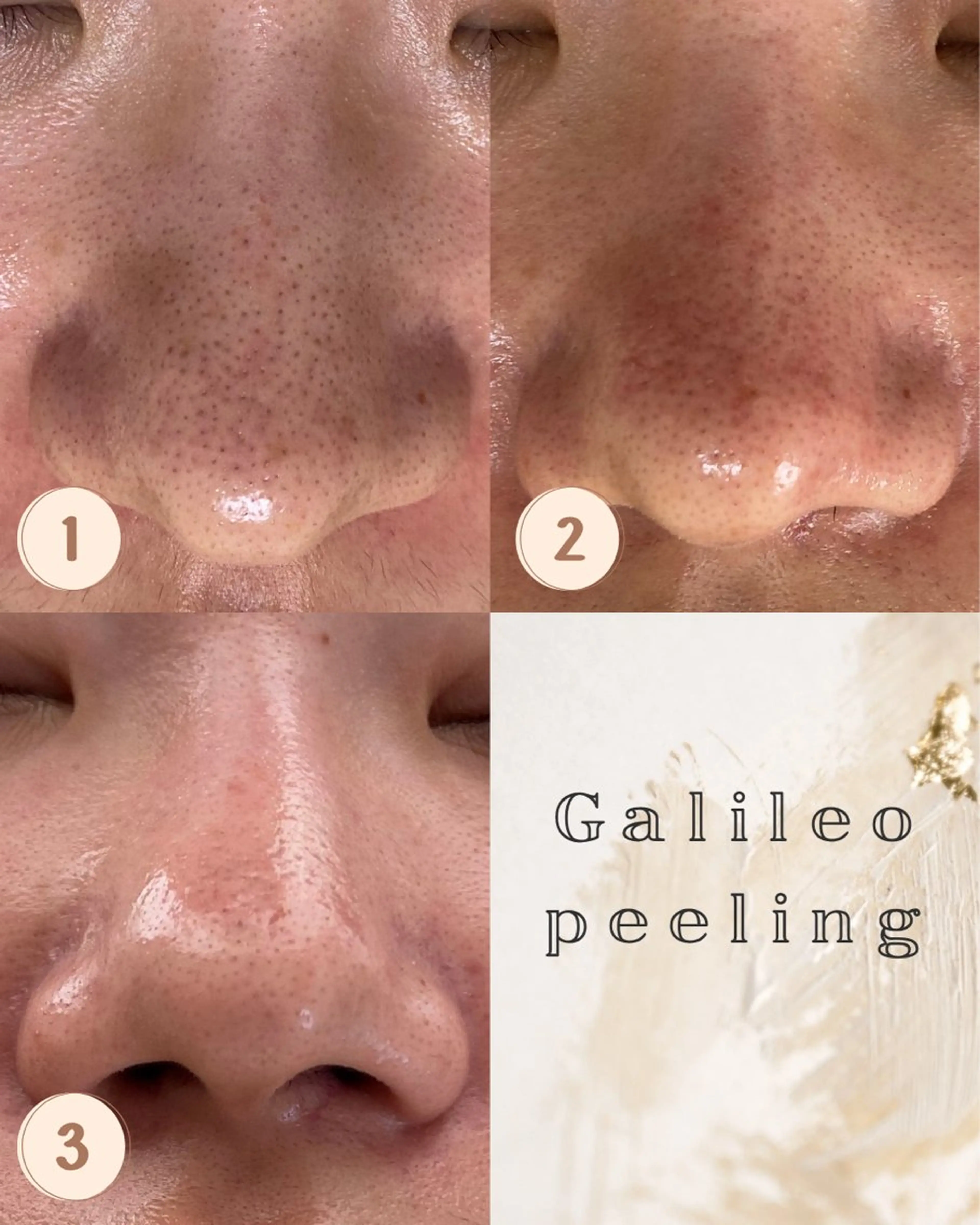 エステ Life＆ Beautifulのエステ・リラクイメージ