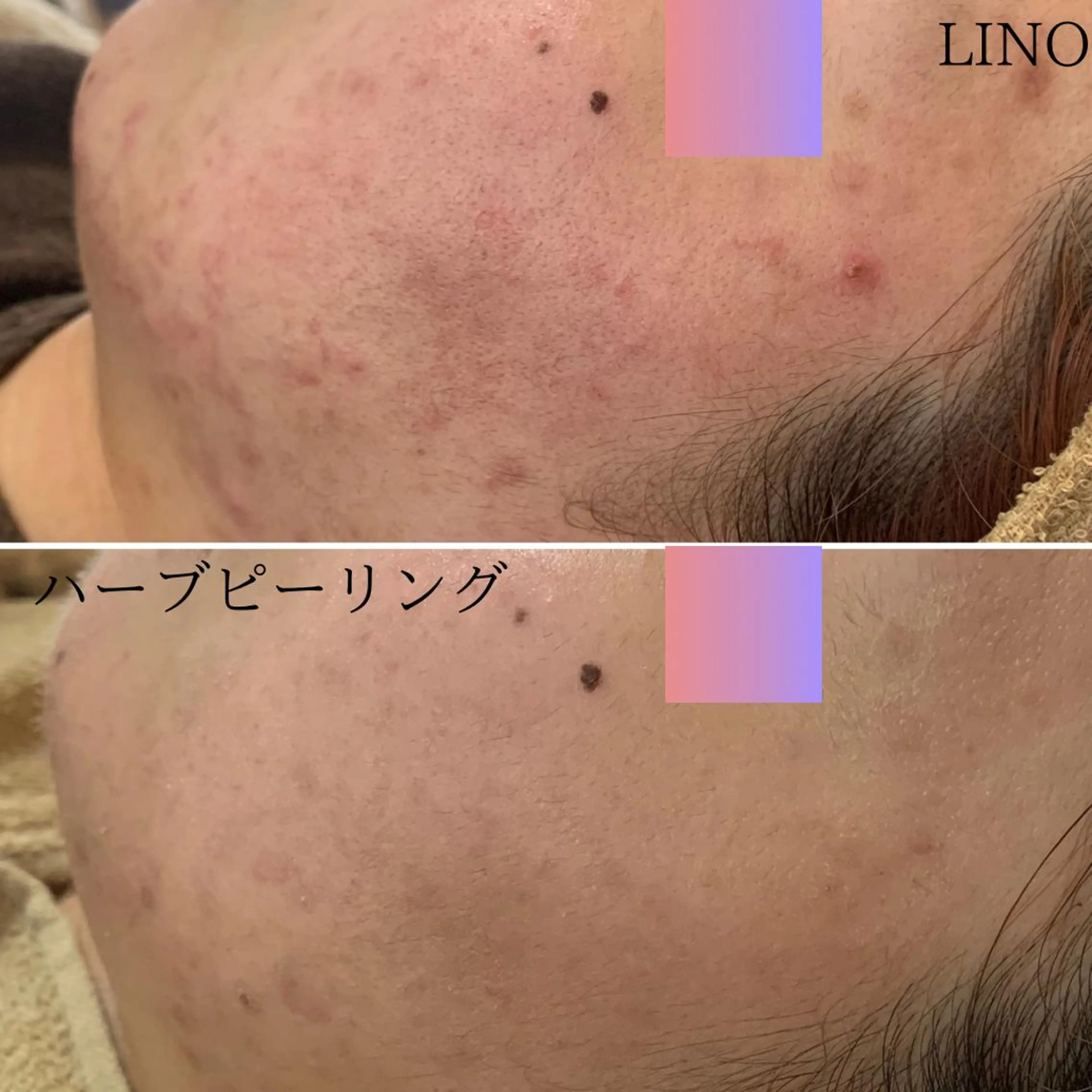 beautysalon  LINO所属・7月限定【平日限定】 全メニュ¥4,400のエステ・リラクイメージ