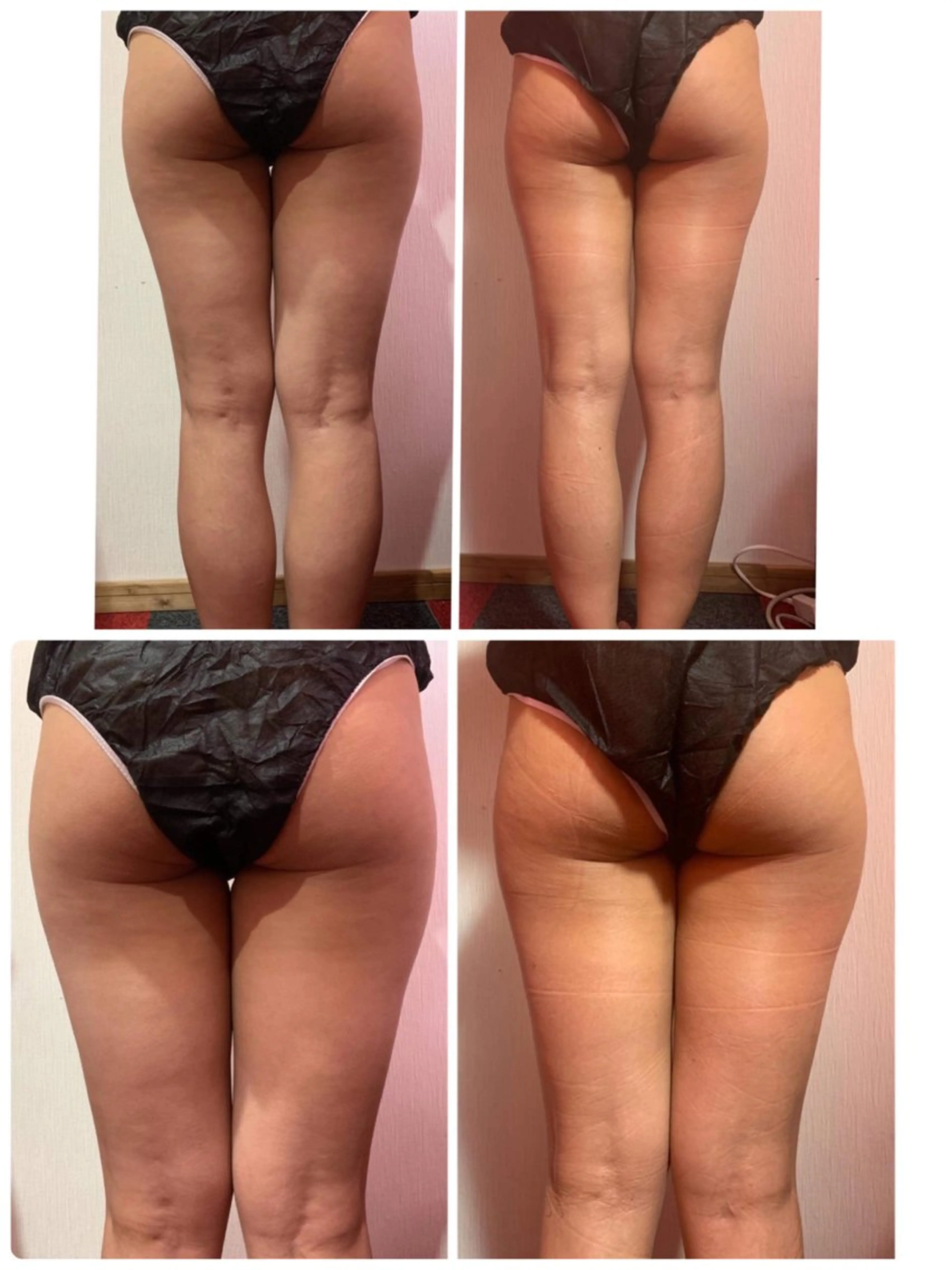 ニキビ、痩身、脱毛、 サクラチャンスパのエステ・リラクイメージ