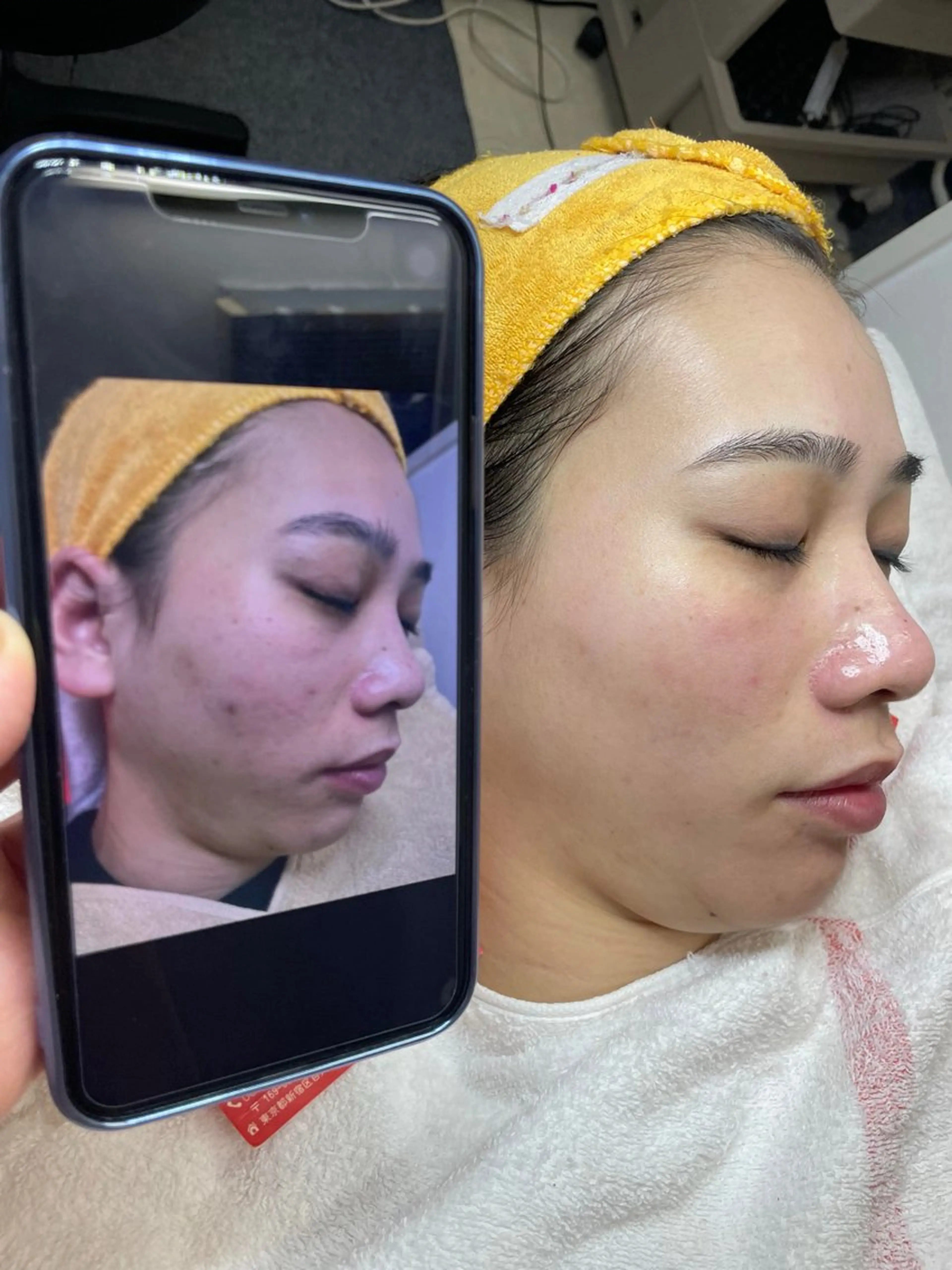 ニキビ、痩身、脱毛、 サクラチャンスパのエステ・リラクイメージ