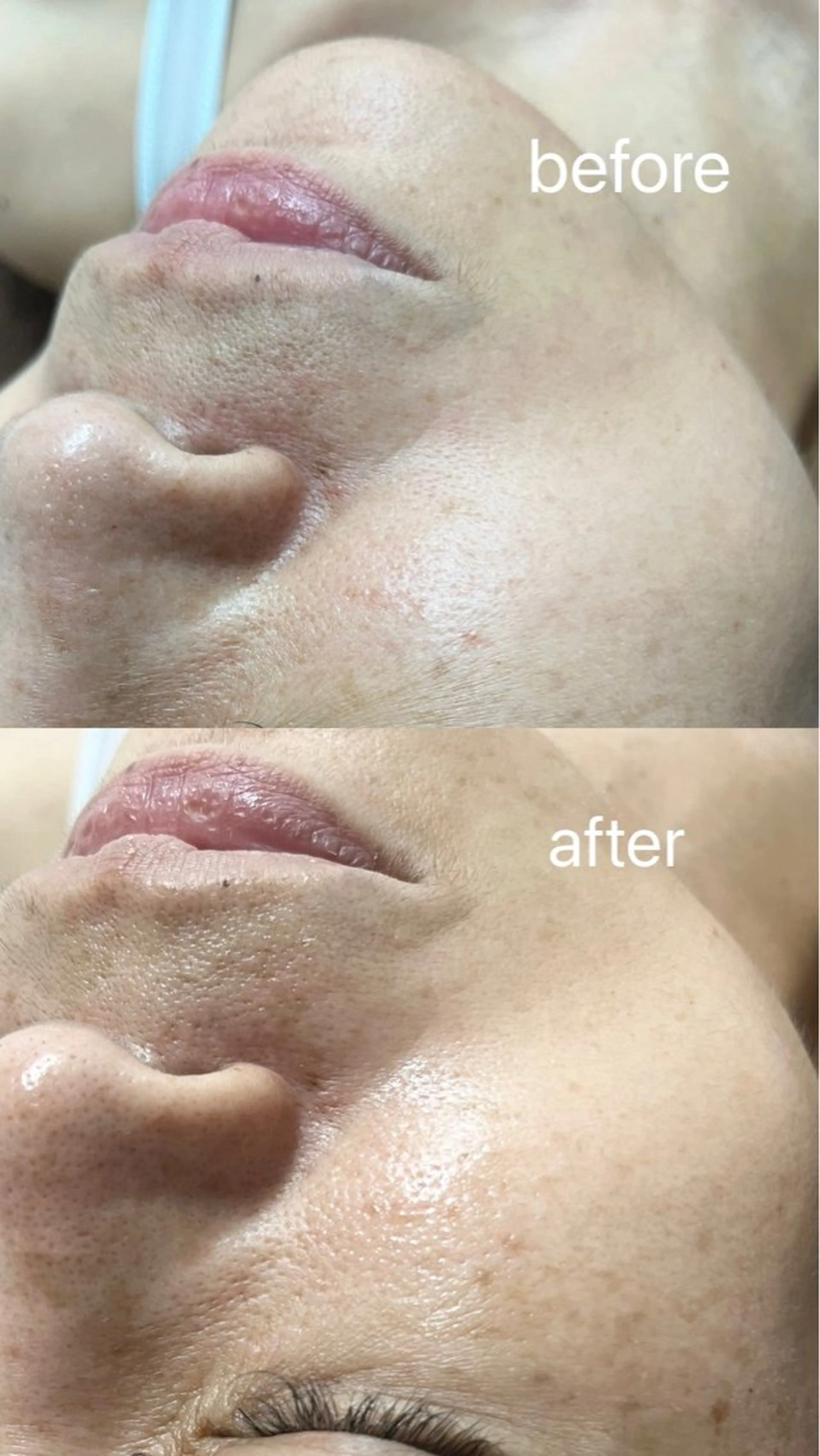 エステ smile nail スマイルネイルのその他イメージ