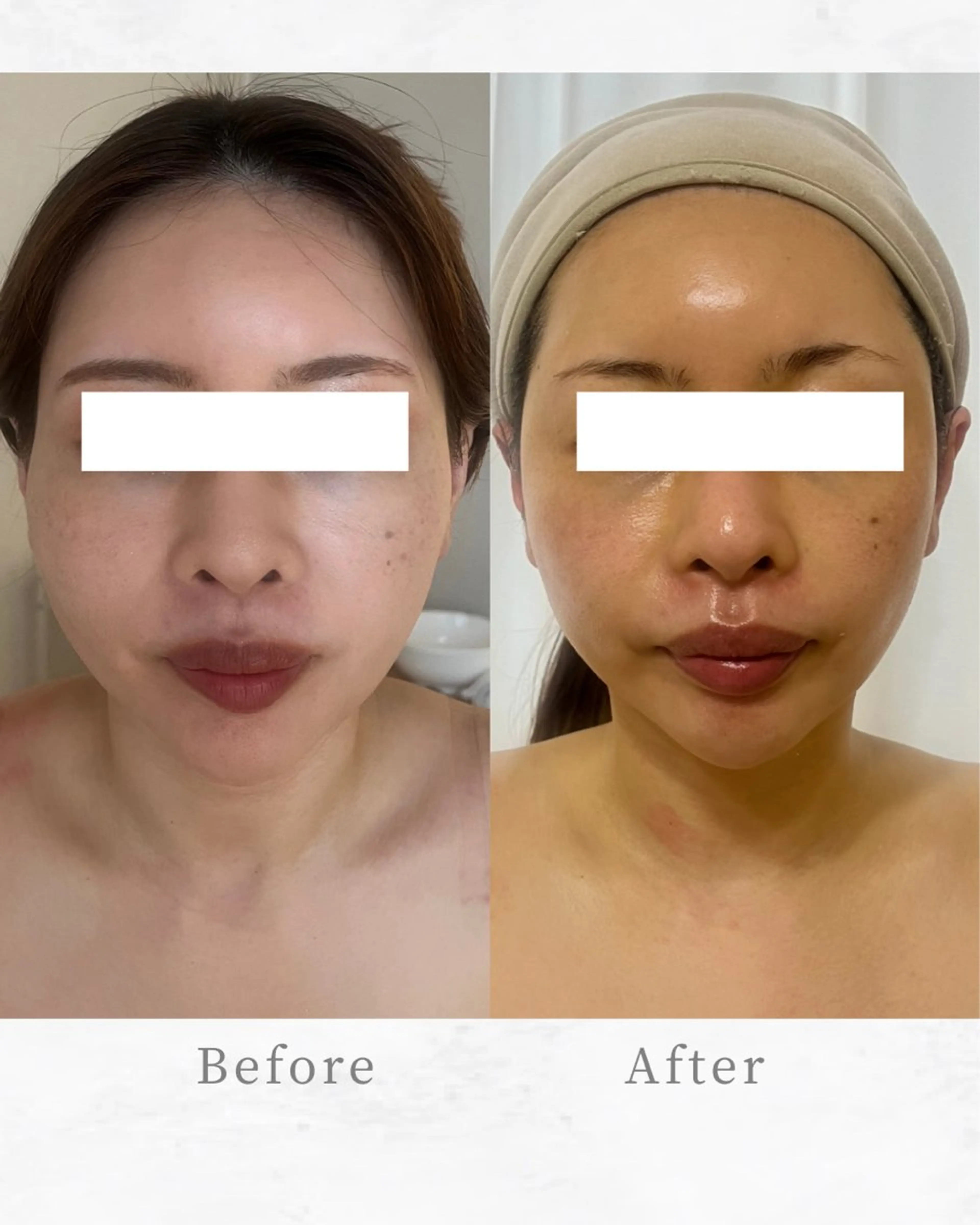 エステ リラク Total Beauty salon Bloom所属・肌育WISHpro 専門サロンBloomのエステ・リラクイメージ