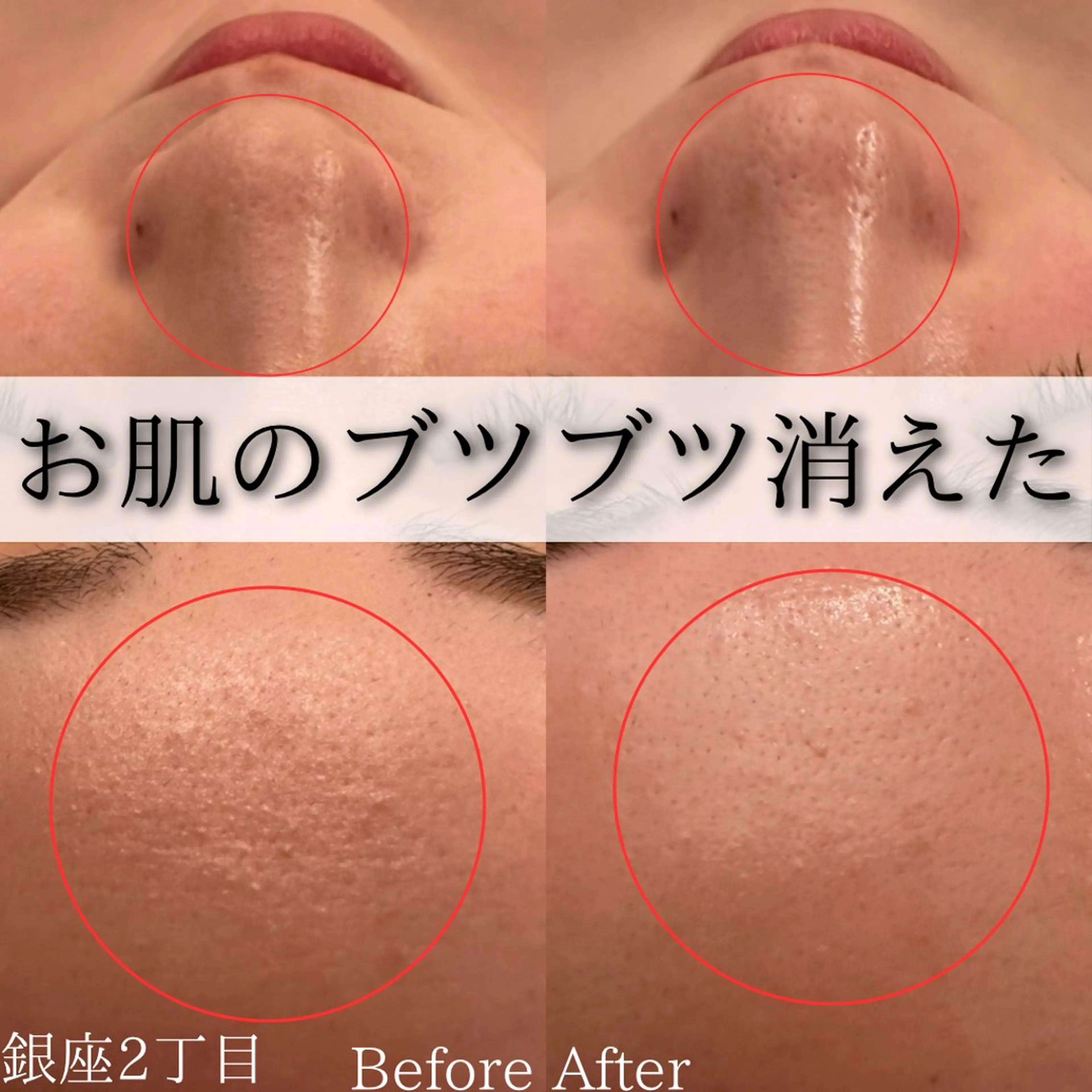 エステ Ginza Charerのエステ・リラクイメージ