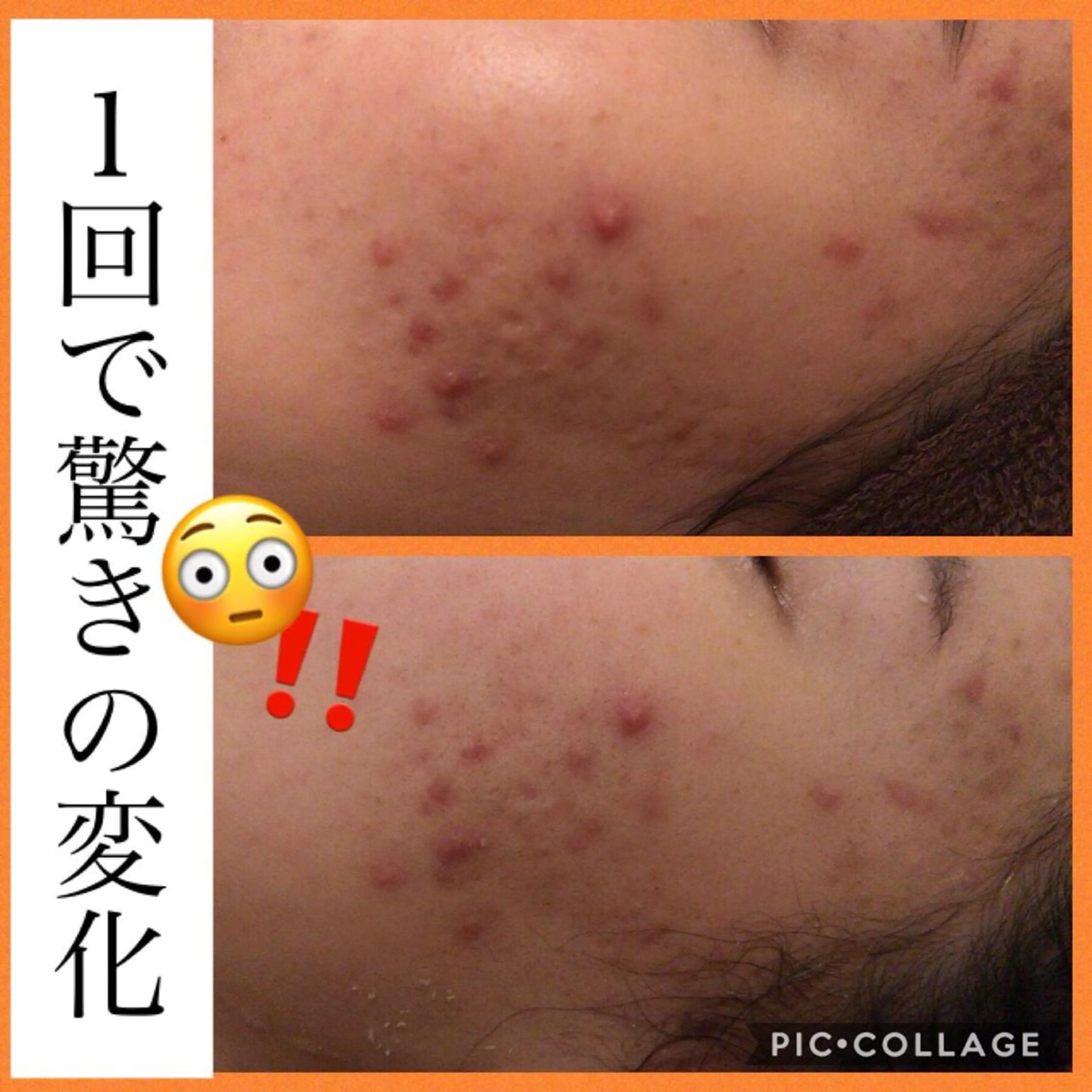 ミディアム カラー パーマ ヘアアレンジ メンズ キッズ ネイル マツエク・マツパ アクール　齋藤 ♡肌トラブル卒業のエステ・リラクイメージ