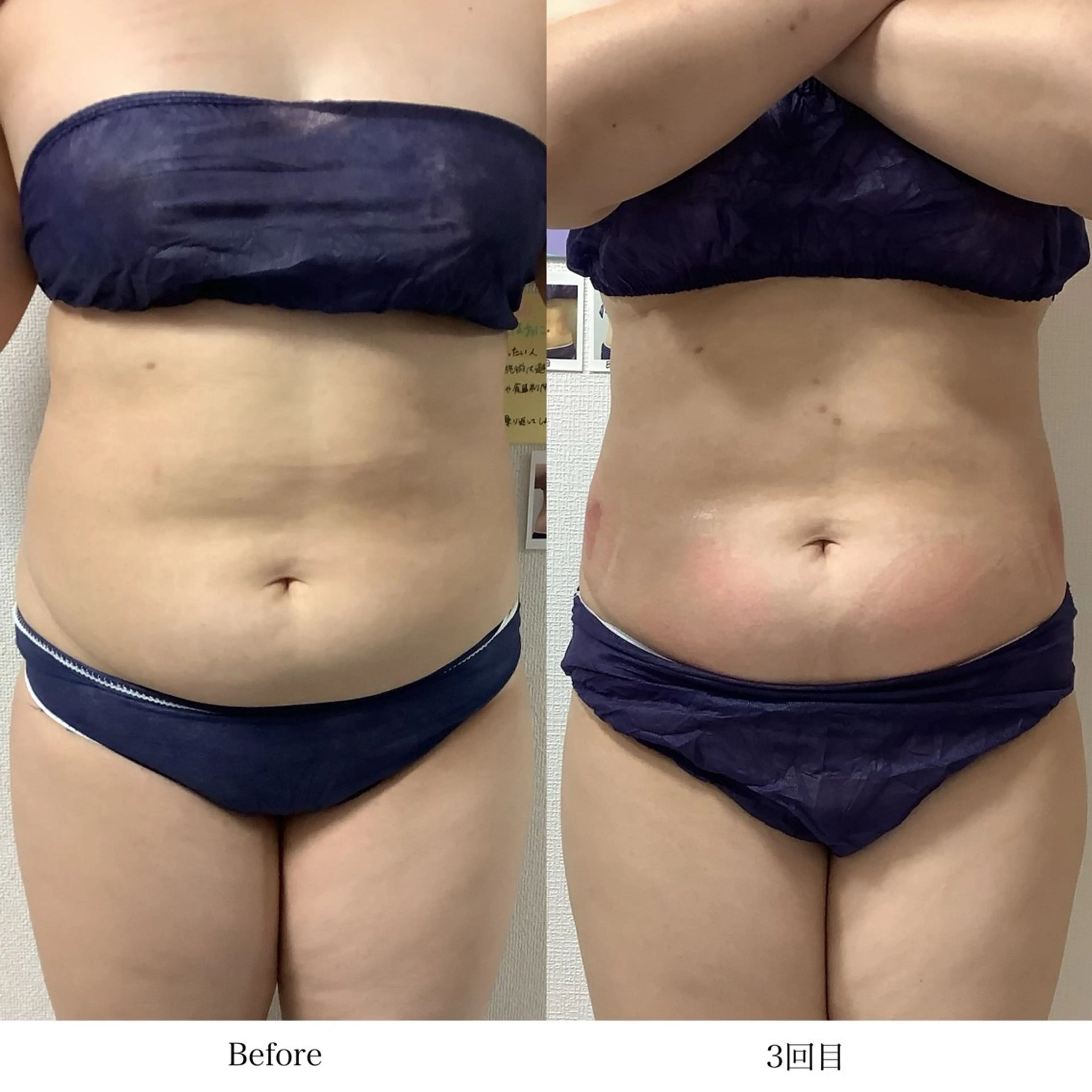 冷却専門店 SLARIのエステ・リラクイメージ