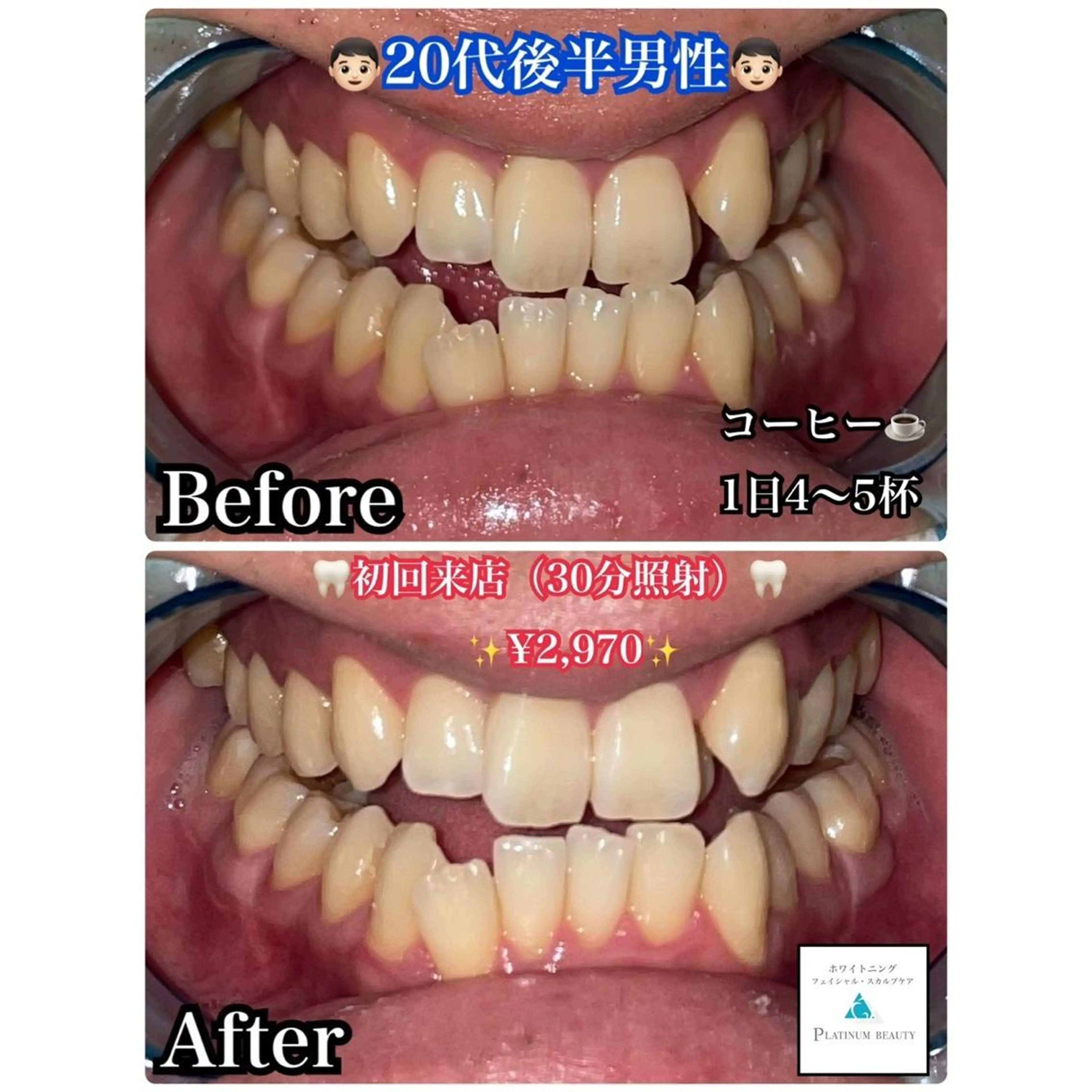 ホワイトニングビューティー西宮店所属・ホワイトニングビュー ティー西宮店のその他イメージ