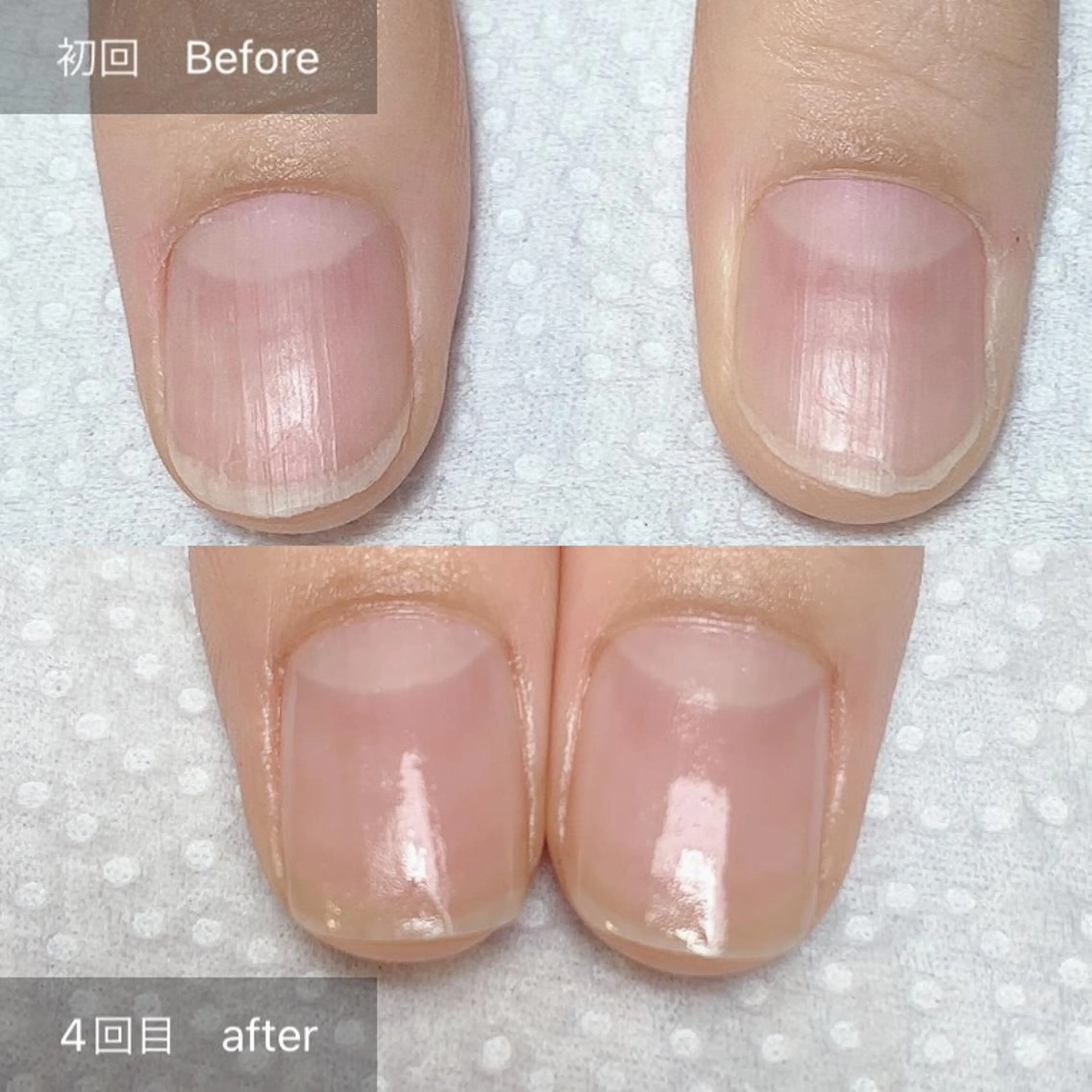 ネイル その他(ネイル) 木村 千晴のネイルデザイン