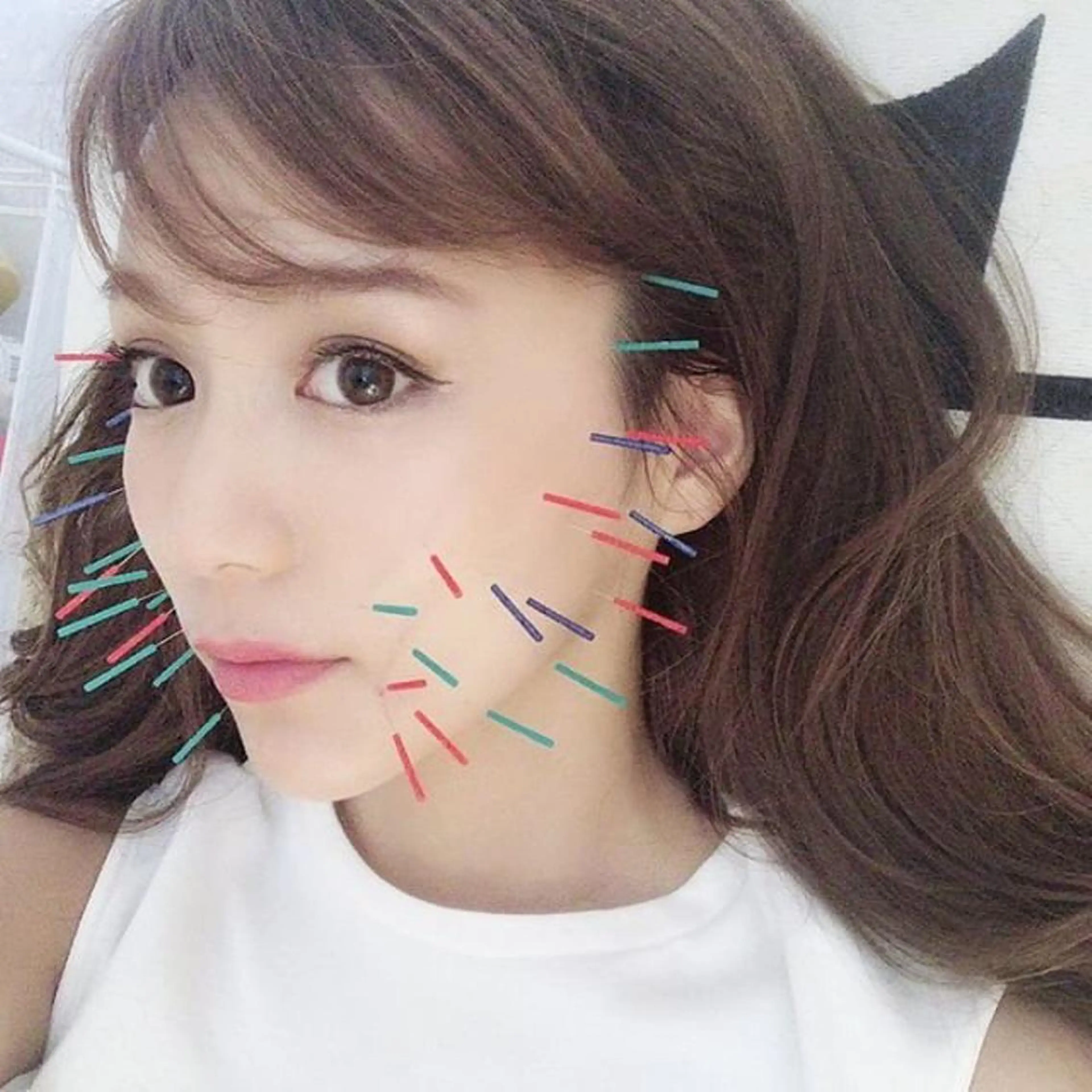 鍼灸整骨院Refine所属・鍼灸 Refineのその他イメージ