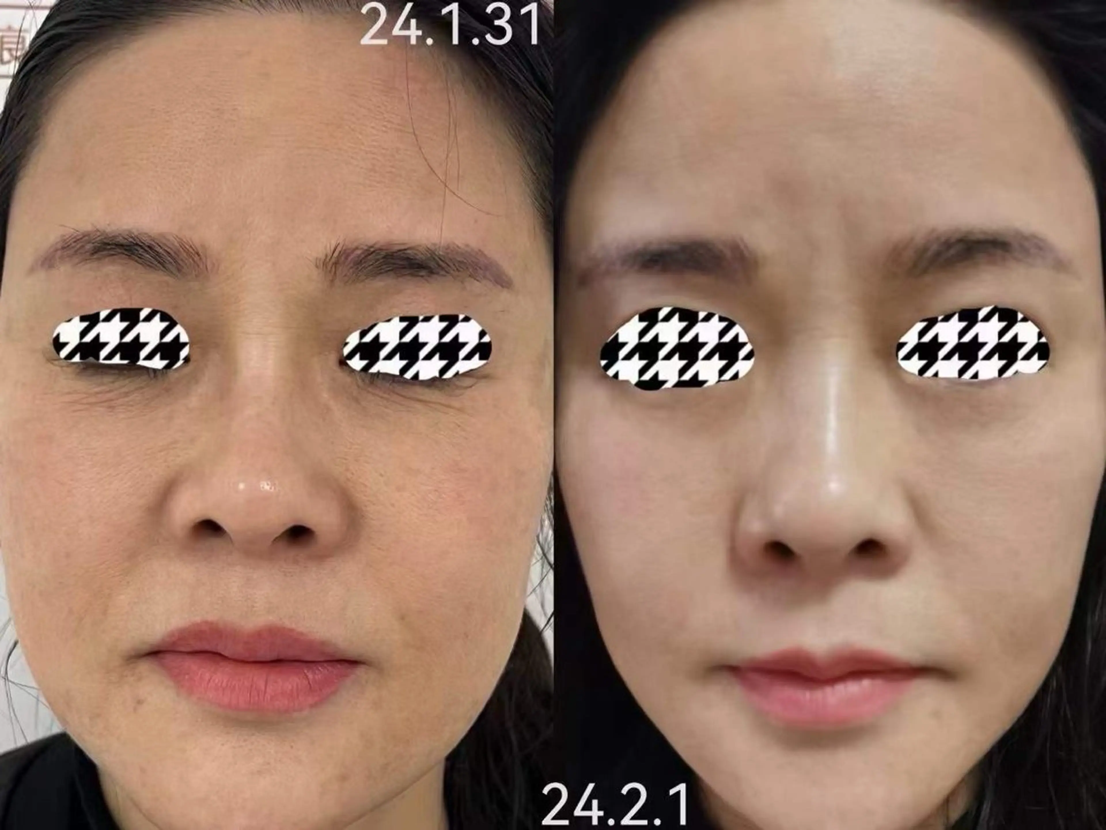 マツエク・マツパ 結婚式・ブライダル エステ aliaハイフ&水光ジェットサロン所属・aliaハーブ水光店 エステティシャン募集のエステ・リラクイメージ