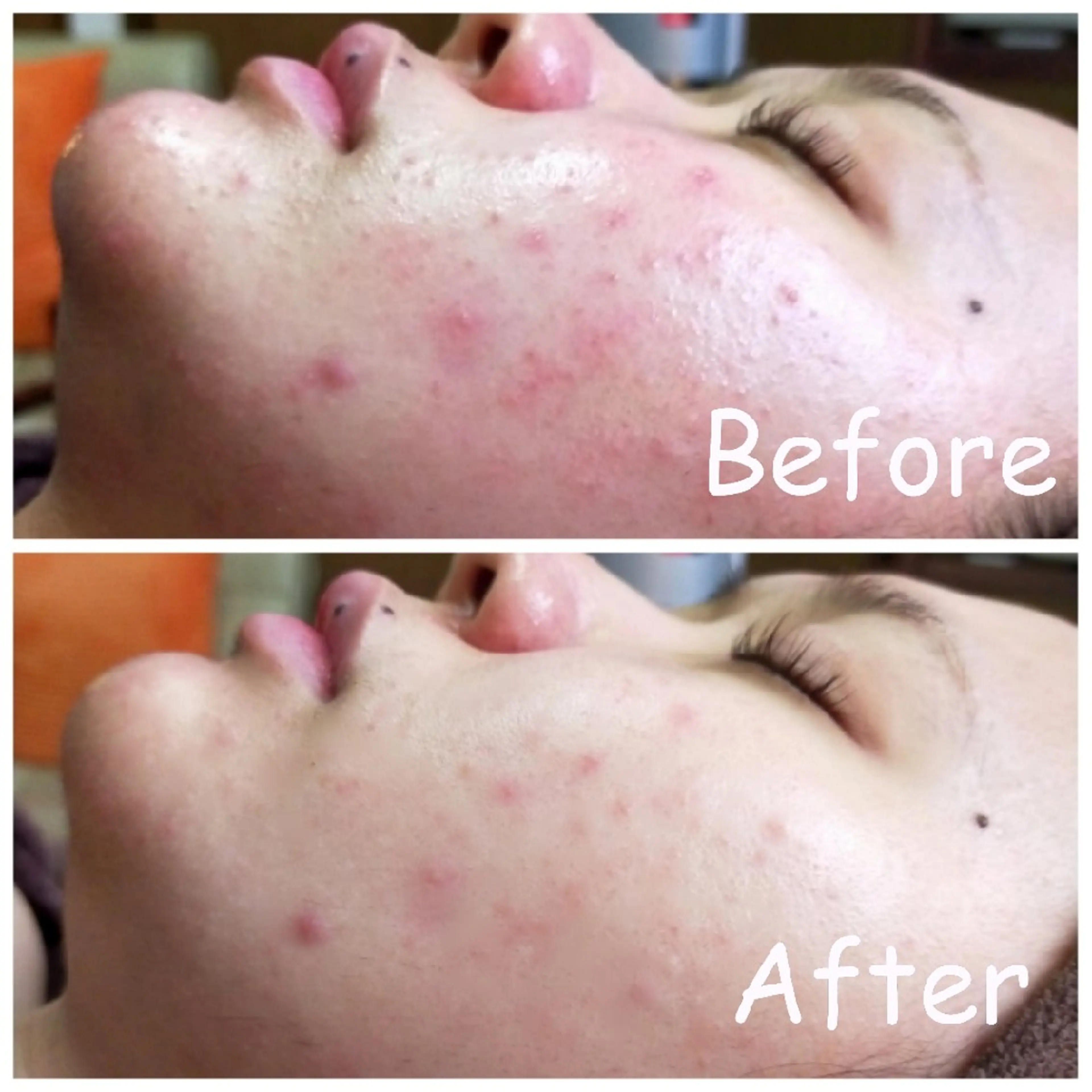 エステ リラク 小顔艶肌＆痩身サロン 🍋 Meguのエステ・リラクイメージ