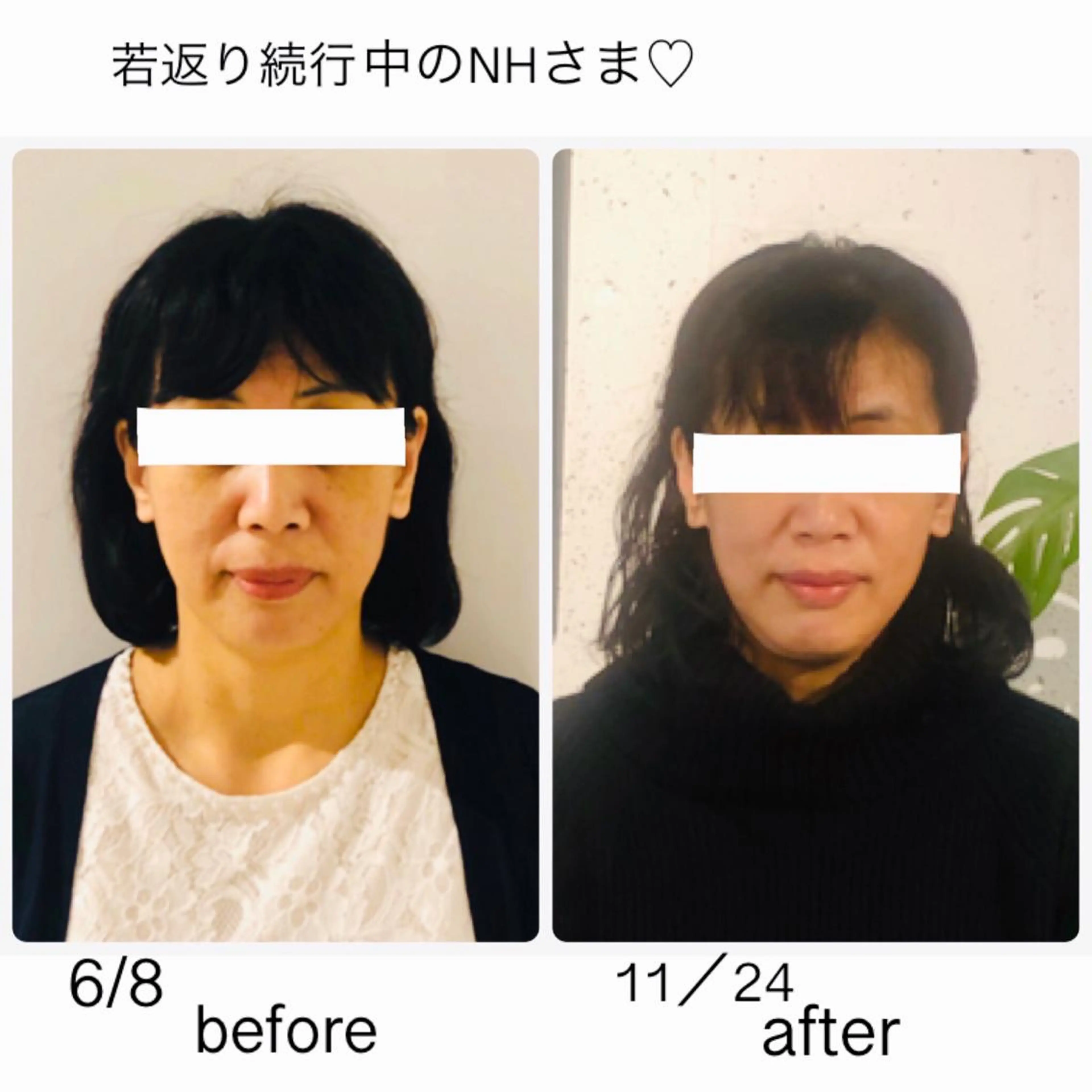 セミロング パーマ 小顔矯正専門サロンジュマリ所属・町田 淳子のエステ・リラクイメージ