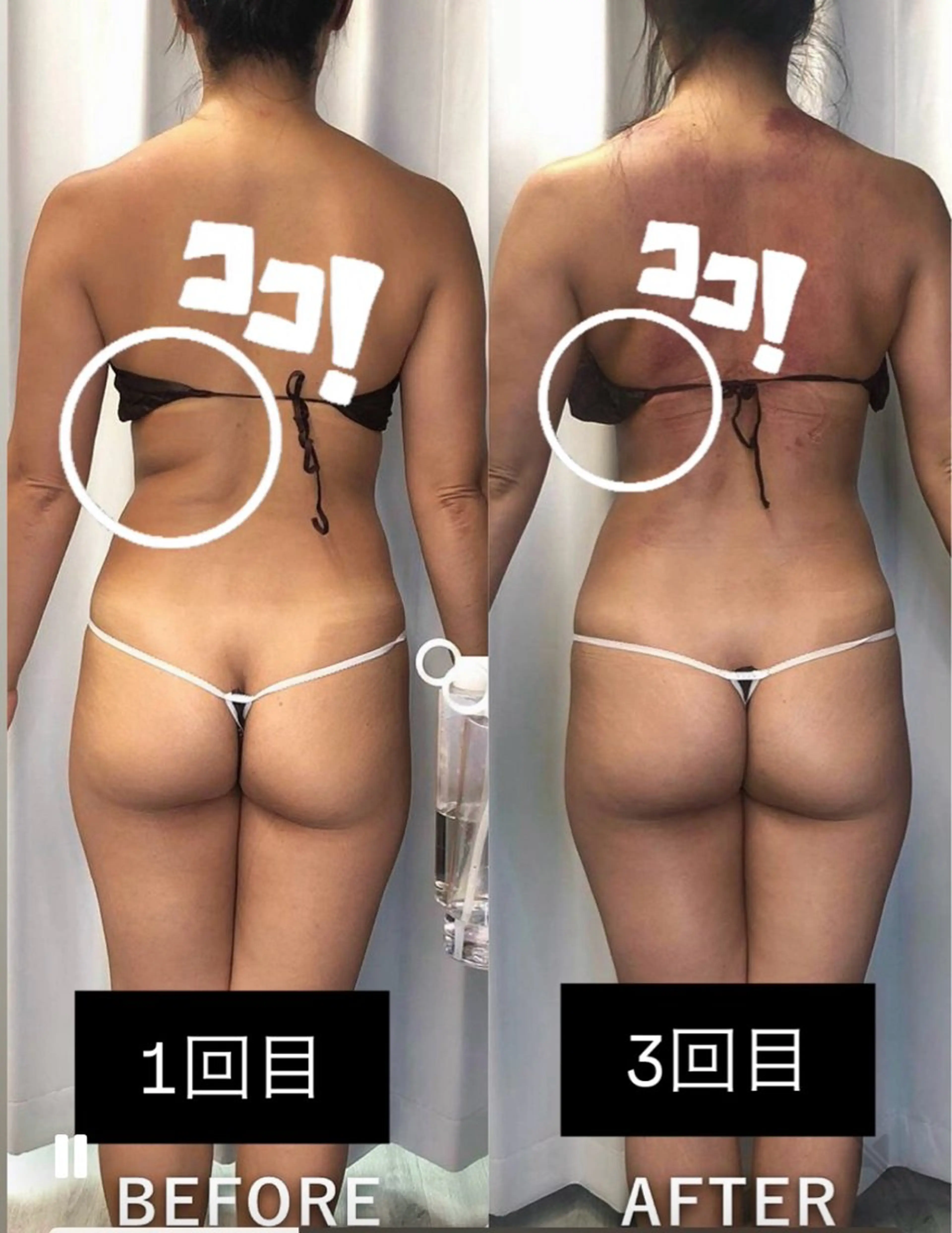 エステ 美容整体・塗る漢方・フェイシャルRechica所属・心斎橋痩身 美容整体×肌管理のエステ・リラクイメージ