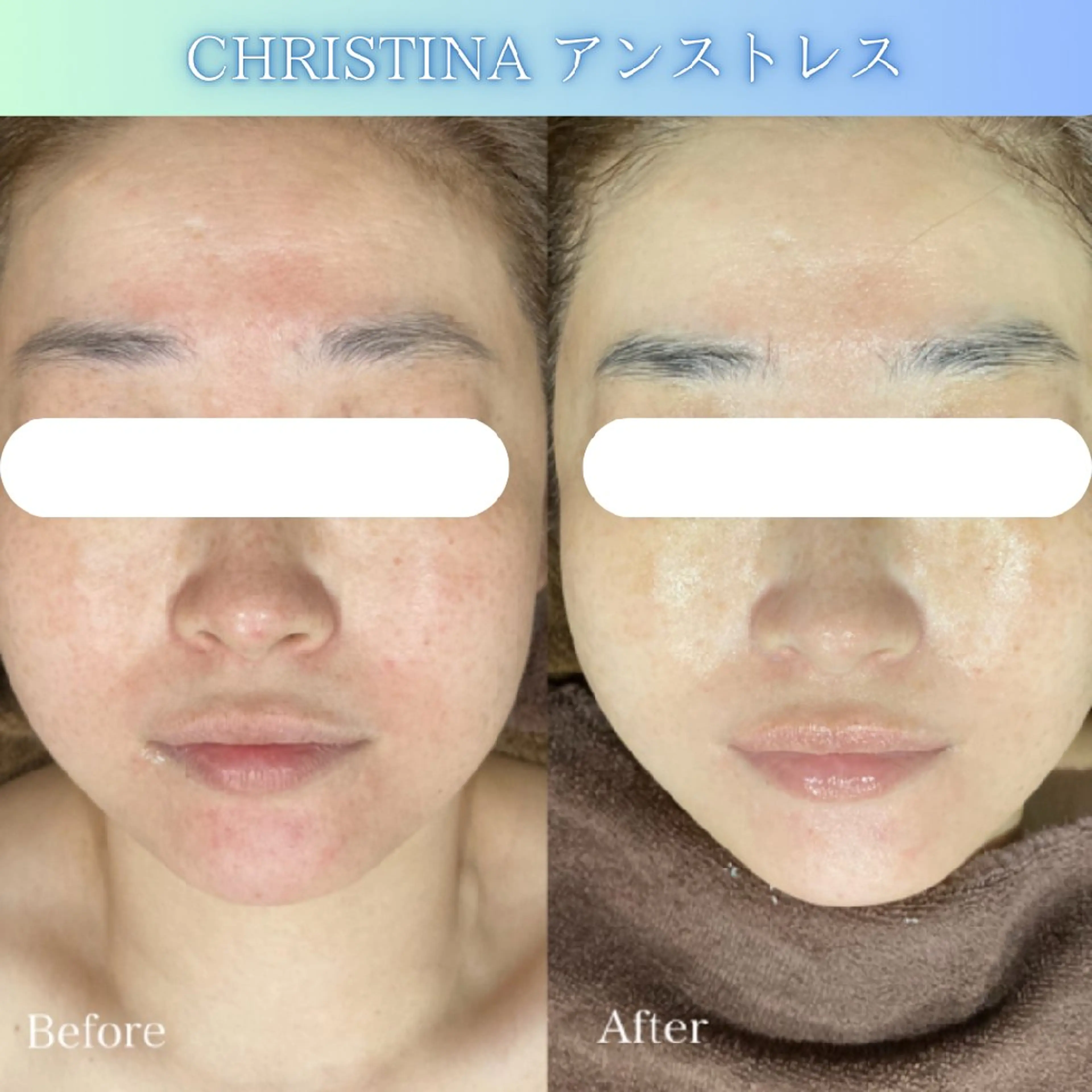 エステ DahliaBeauty ダリアビューティー所属・春日井市Dahlia Beauty　中村のエステ・リラクイメージ