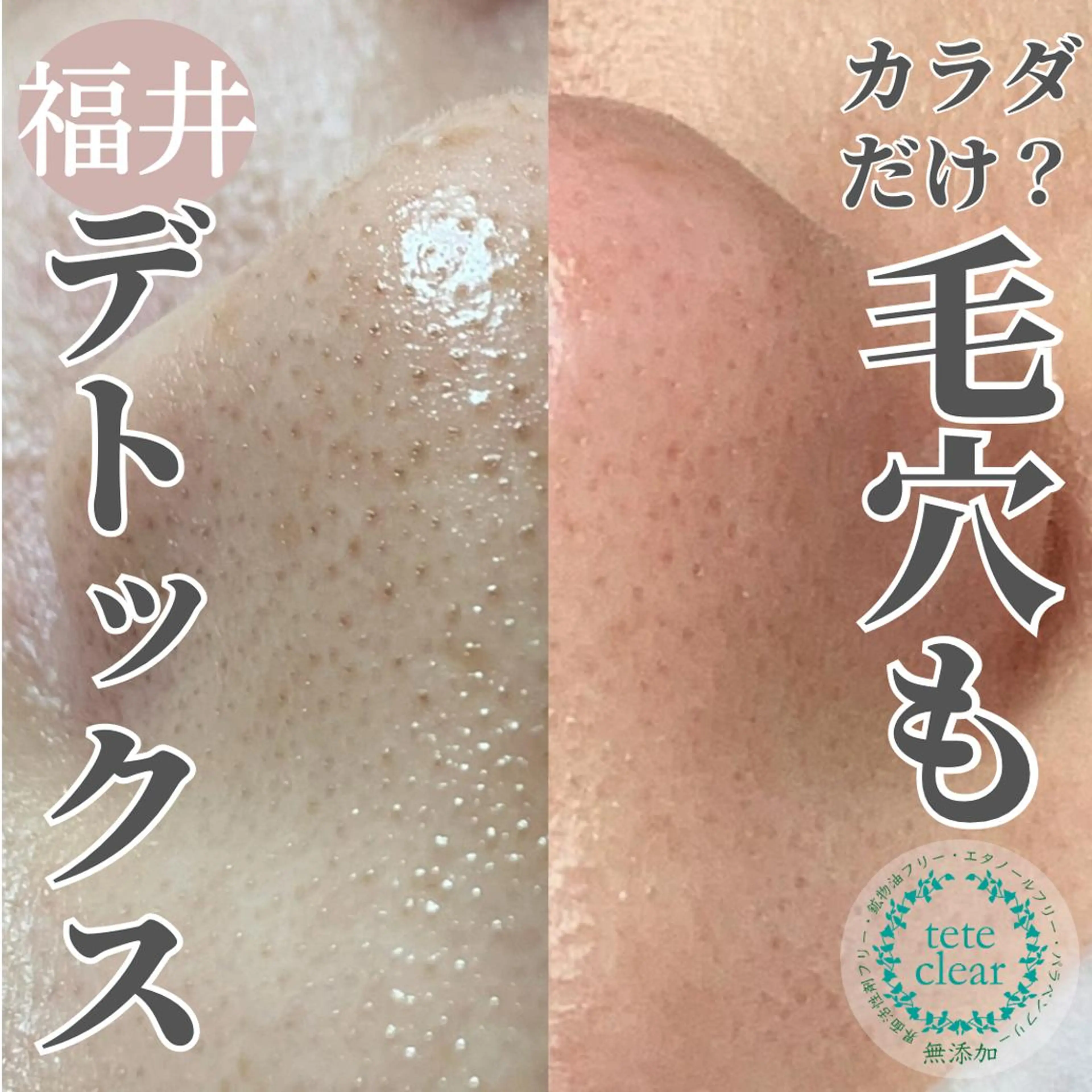 毛穴ケア専門サロン Yourmeユアミーのエステ・リラクイメージ